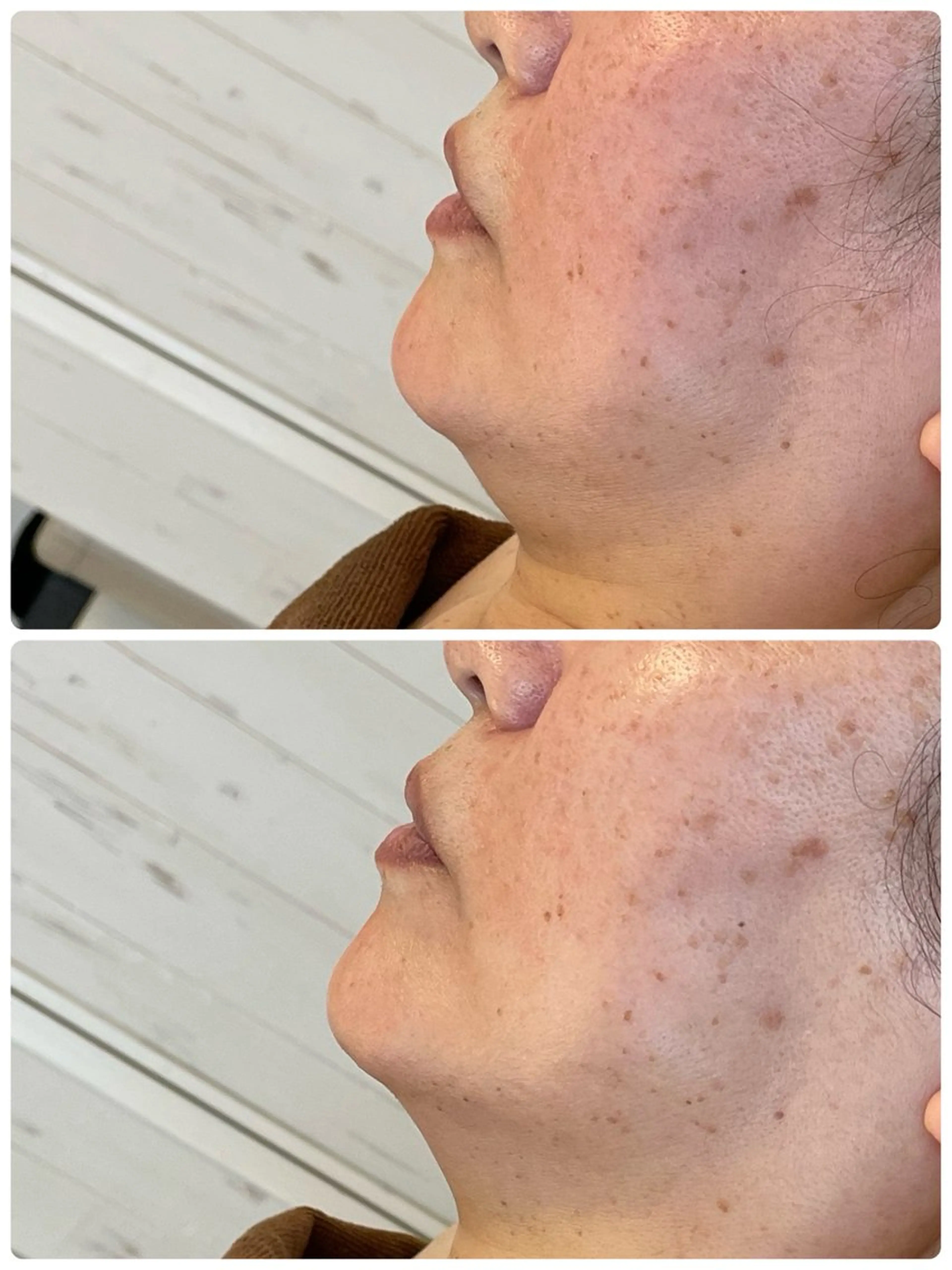 エステ リラク 小顔・たるみケア✨ フェイシャル&ボディのエステ・リラクイメージ