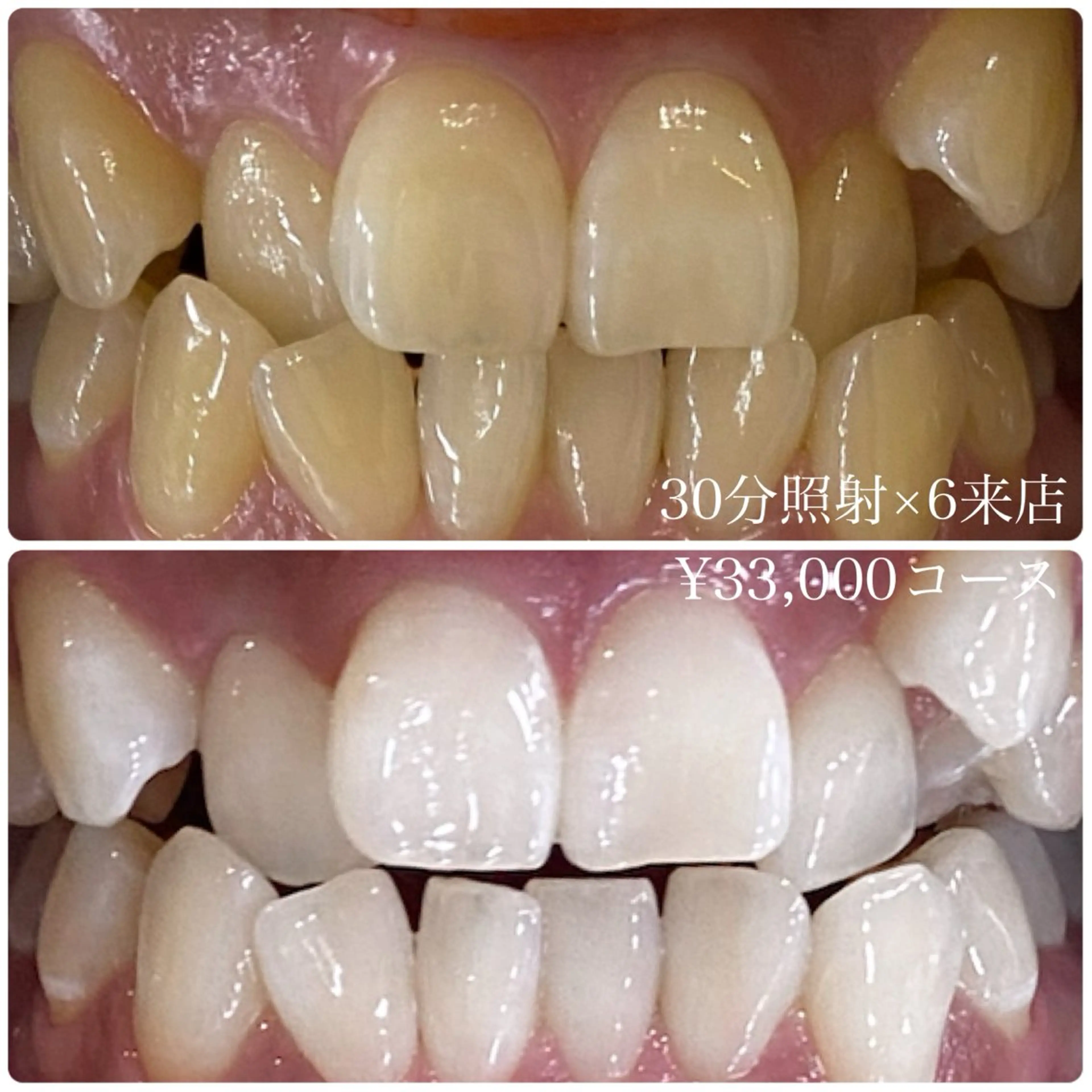 メンズ その他 ホワイトニングルーム　川崎店所属・ホワイトニング ルーム　川崎店のその他イメージ