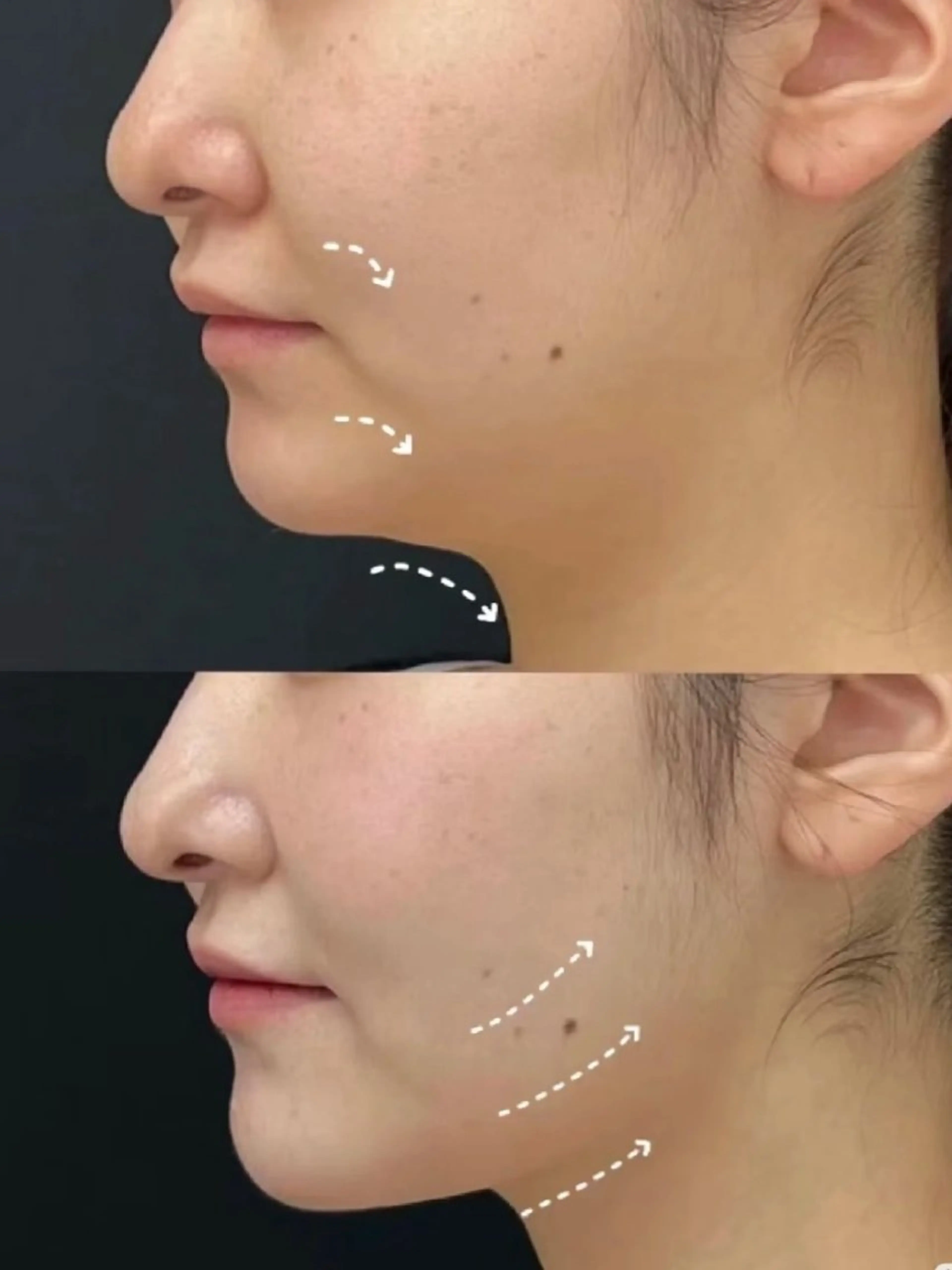 エステ aliaハイフ&水光ジェットサロン所属・aliaハーブ水光店 エステティシャン募集のエステ・リラクイメージ