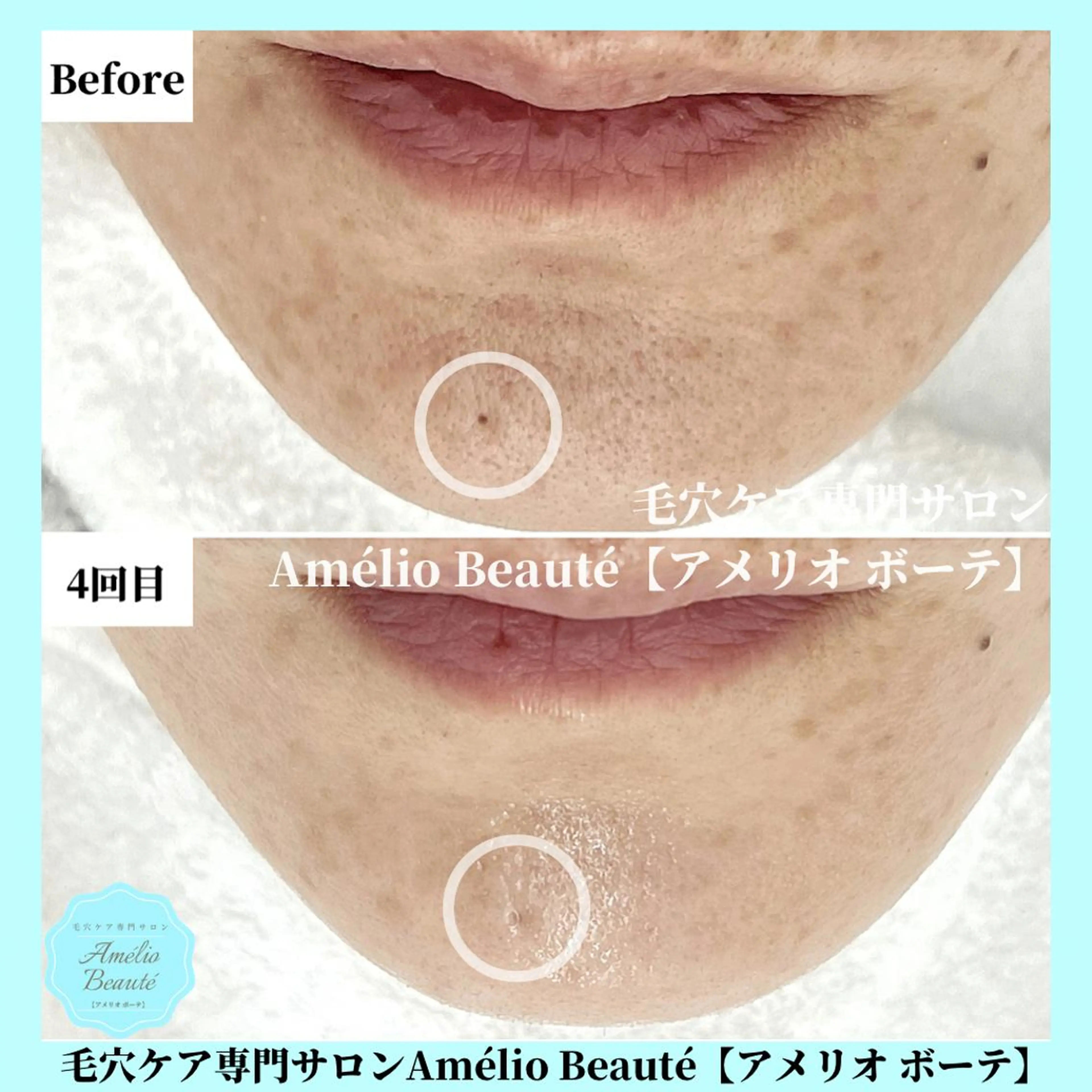 毛穴ケア専門サロン Amélio Beauté所属・毛穴ケア専門サロン アメリオボーテのその他イメージ
