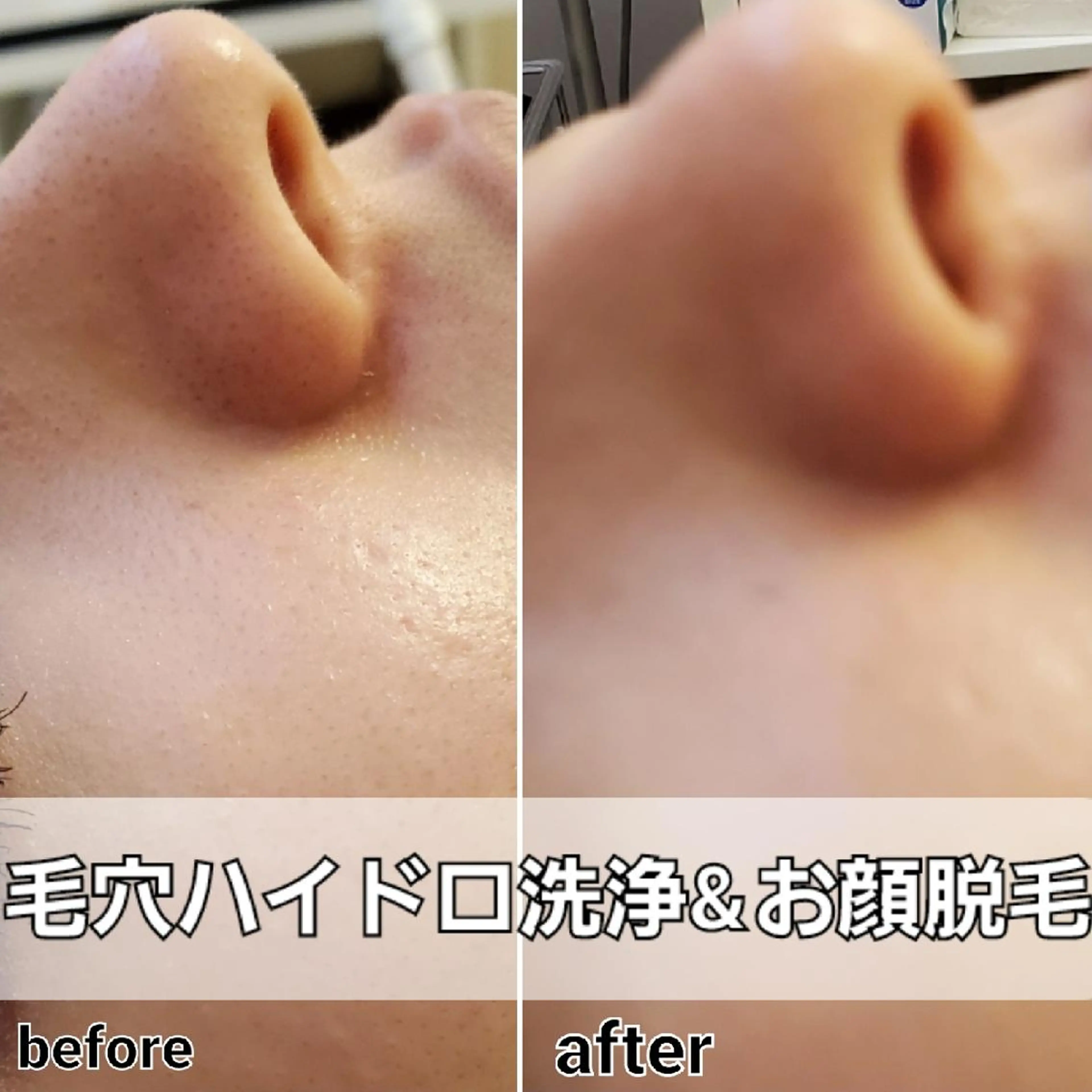 メンズ 小顔・美肌ケア専門 Diva北浜のエステ・リラクイメージ