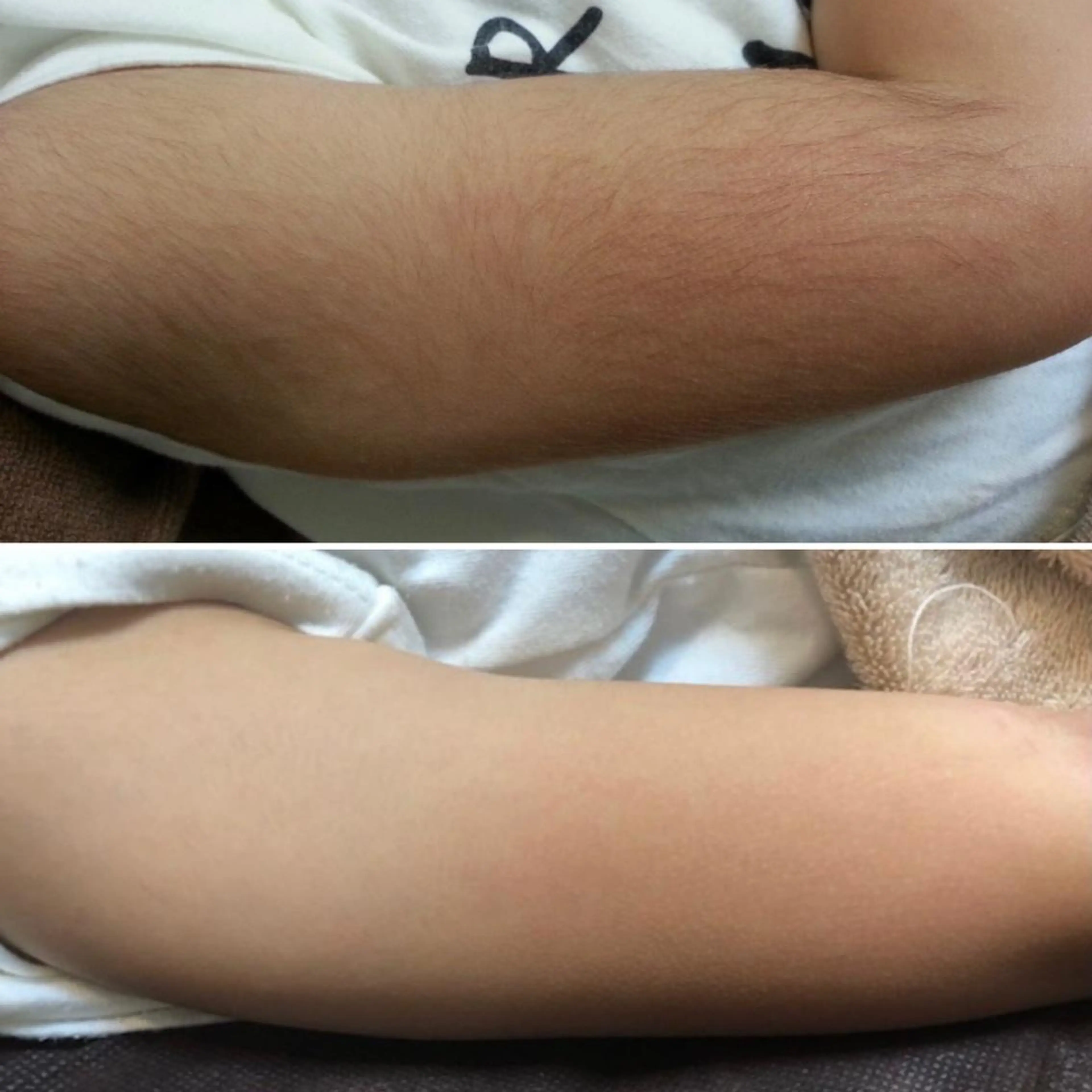 脱毛 ULULU上野店所属・ULULU 上野店のエステ・リラクイメージ