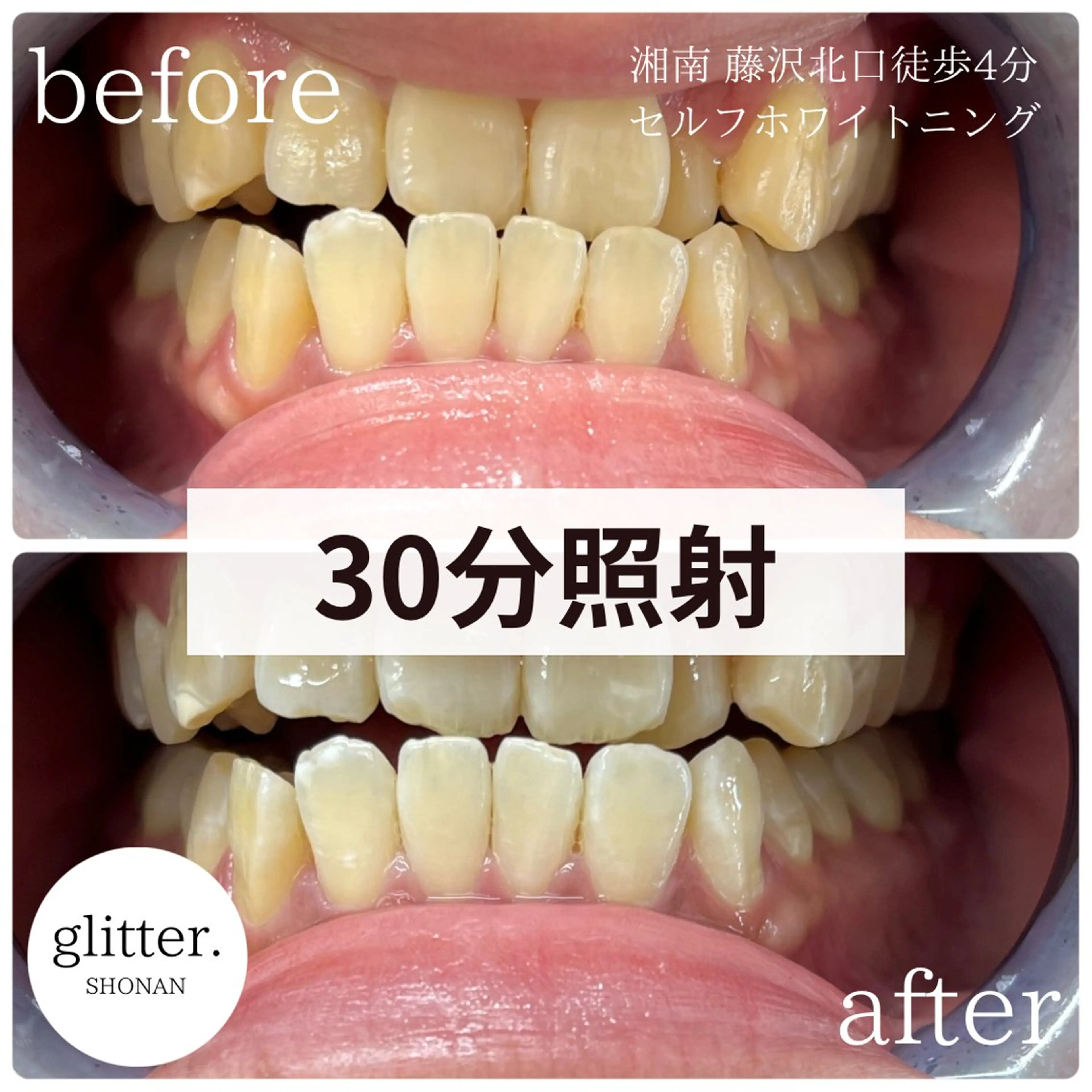 glitter.SHONAN所属・佐久間 茉弥のエステ・リラクイメージ