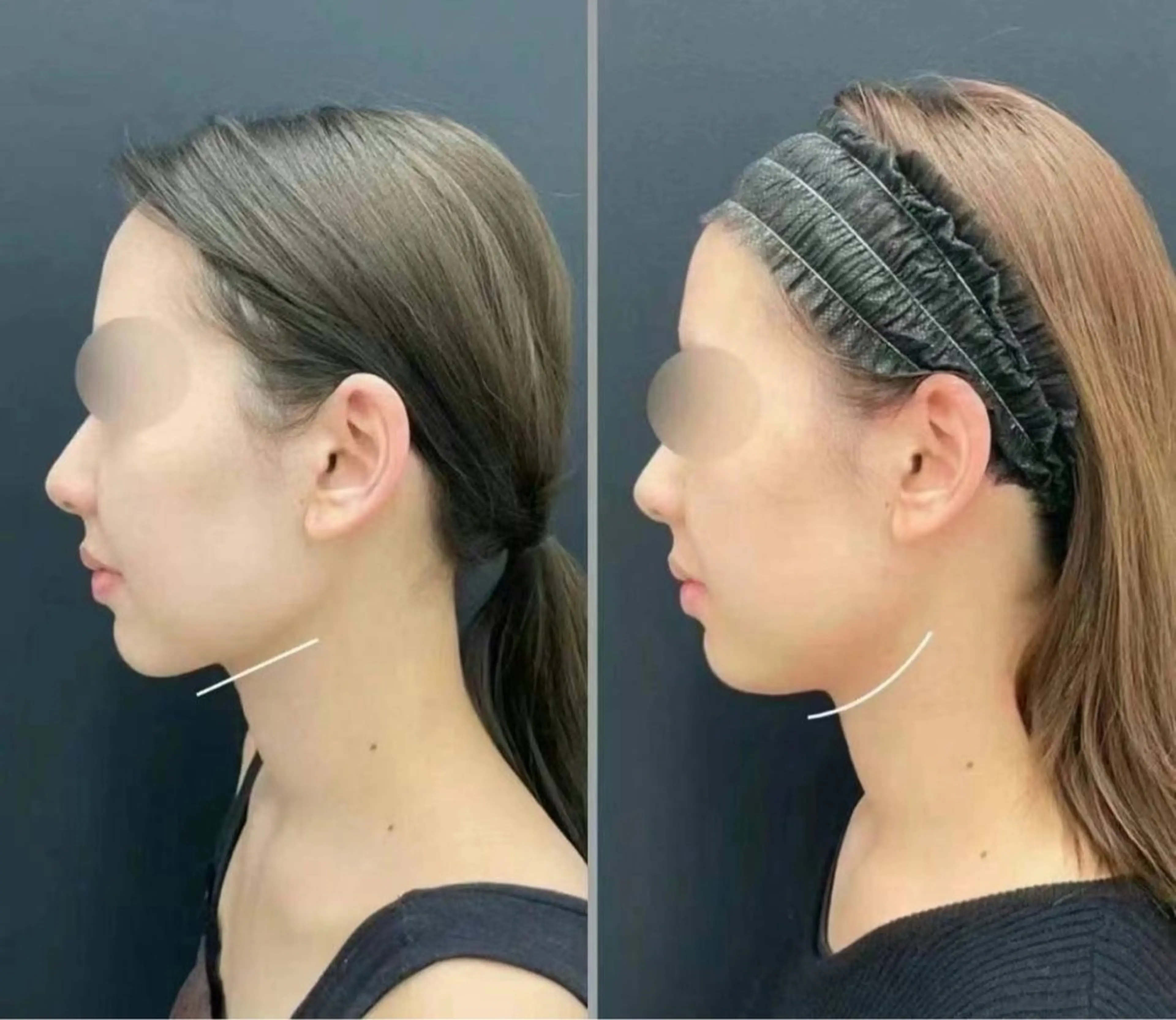 マツエク・マツパ エステ aliaハイフ&水光ジェットサロン所属・aliaハーブ水光店 エステティシャン募集のエステ・リラクイメージ