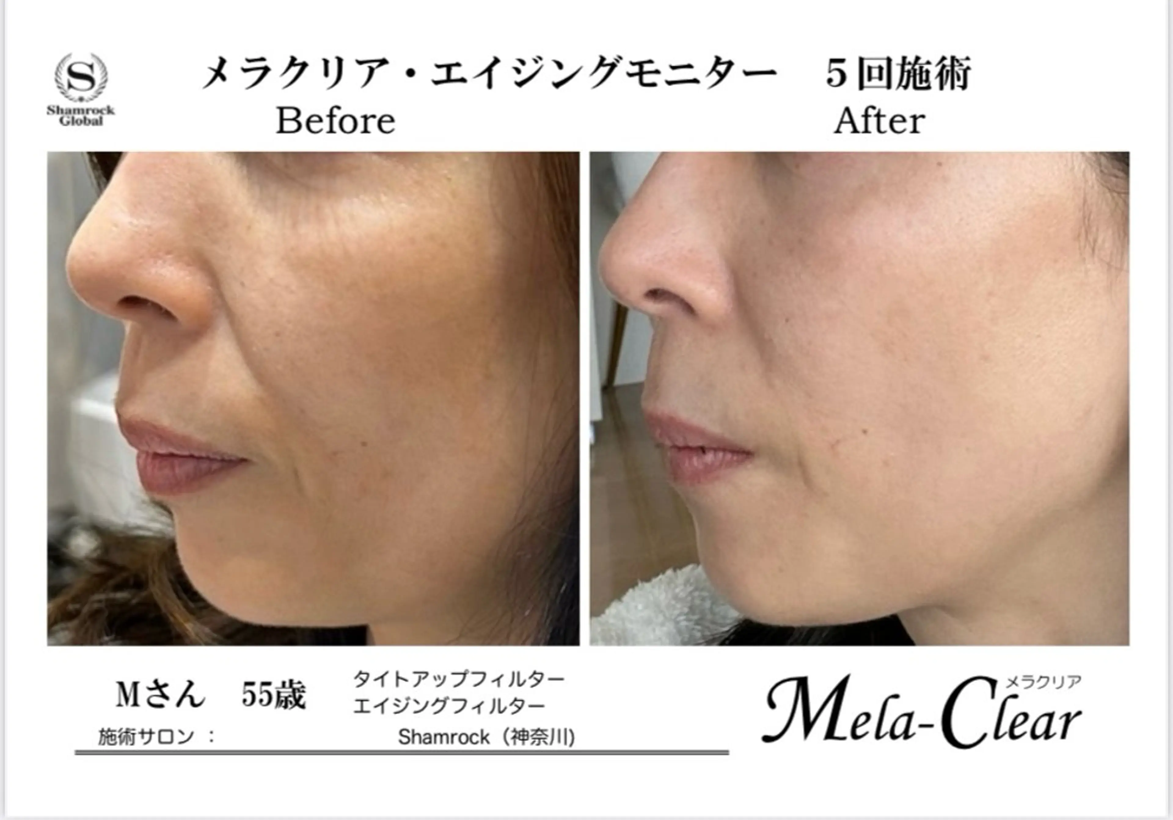 光フォト美容 エイジング、敏感肌のエステ・リラクイメージ