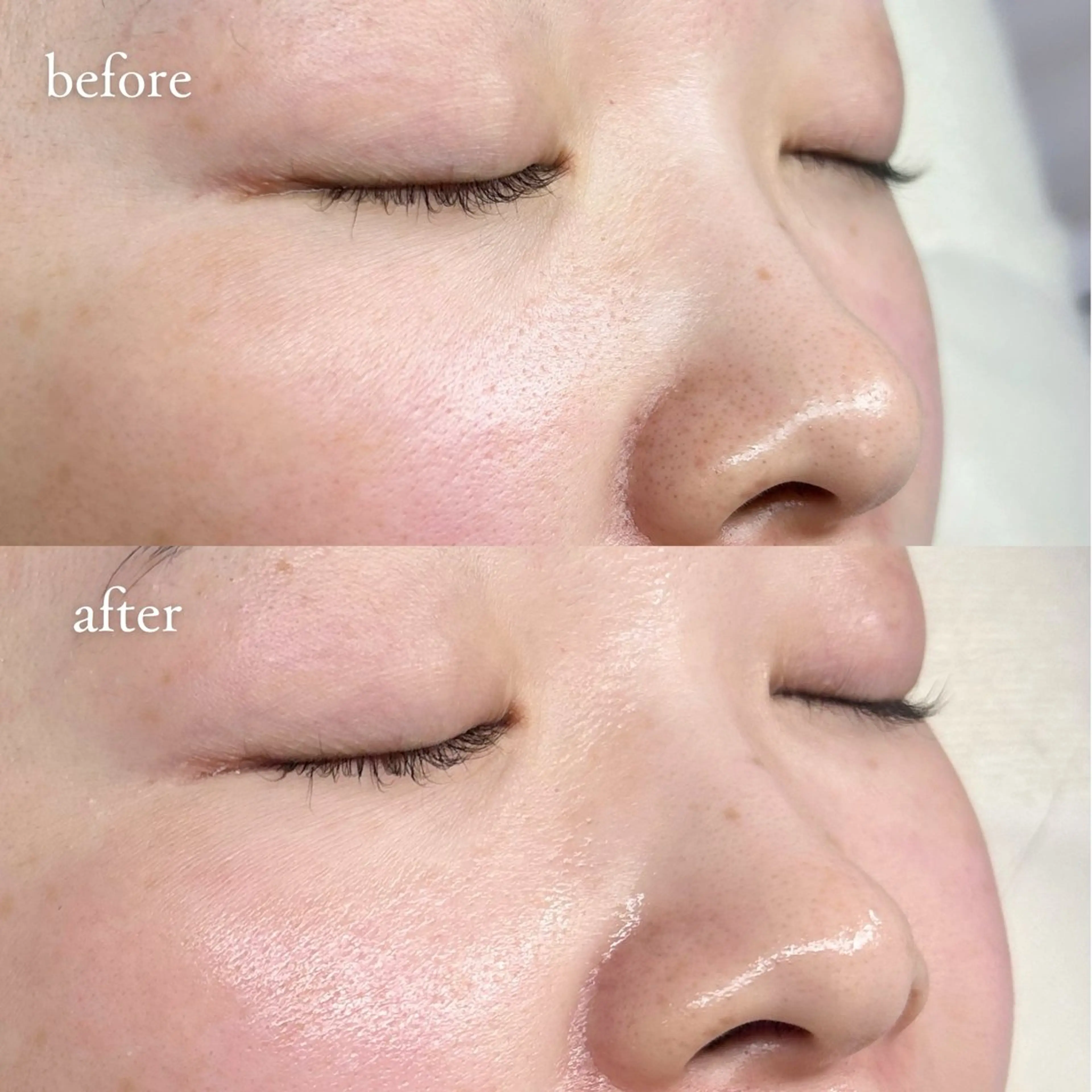 【セットメニュー】美眉スタイリング+フェイスワックス（鎮静マスク付き）🌱✨の写真