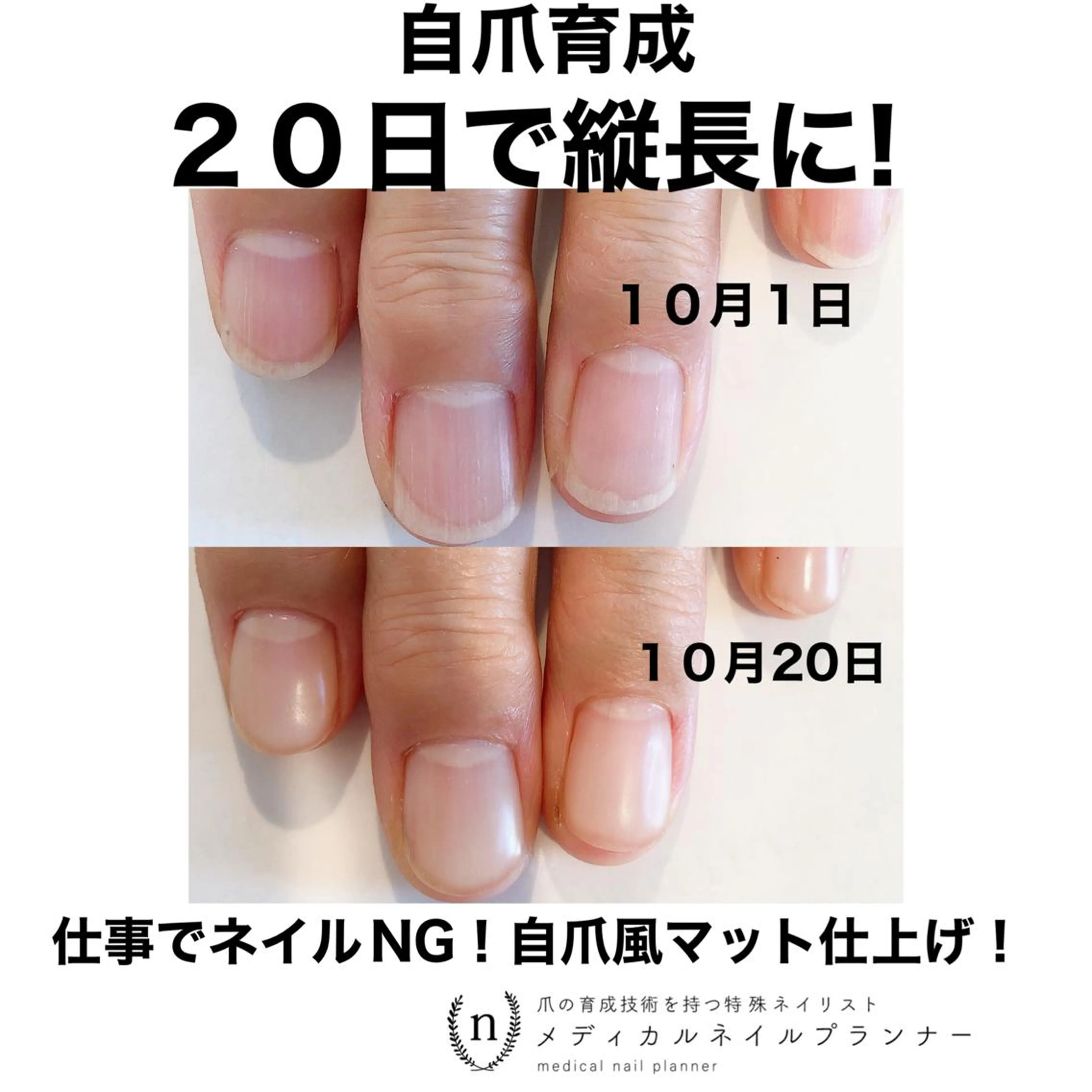 ネイル NAIL SALON ｔｏｇｇｙのネイルデザイン