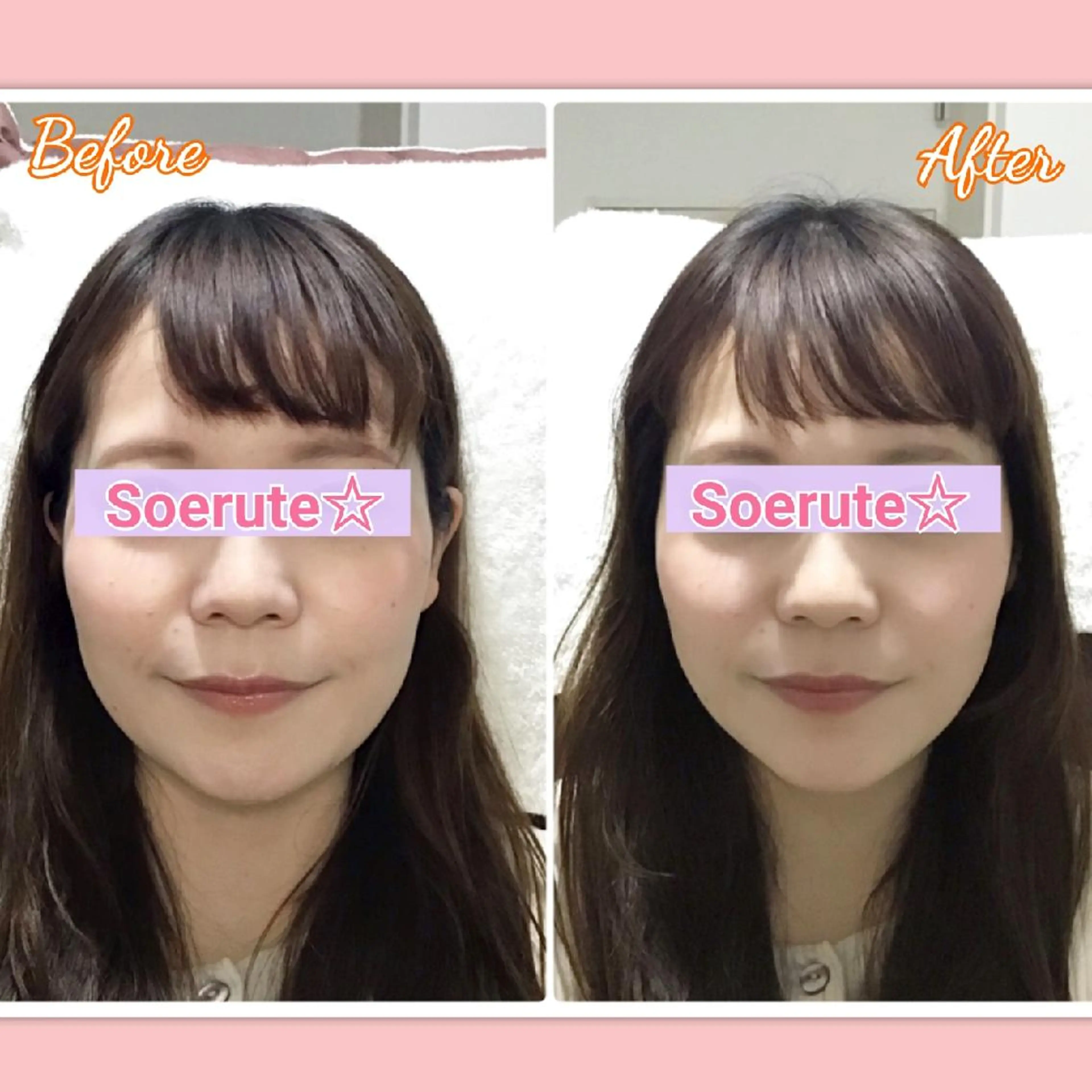 【📷小顔モニター募集中】周りから憧れられる小顔へ☆美容 小顔矯正　30分の写真