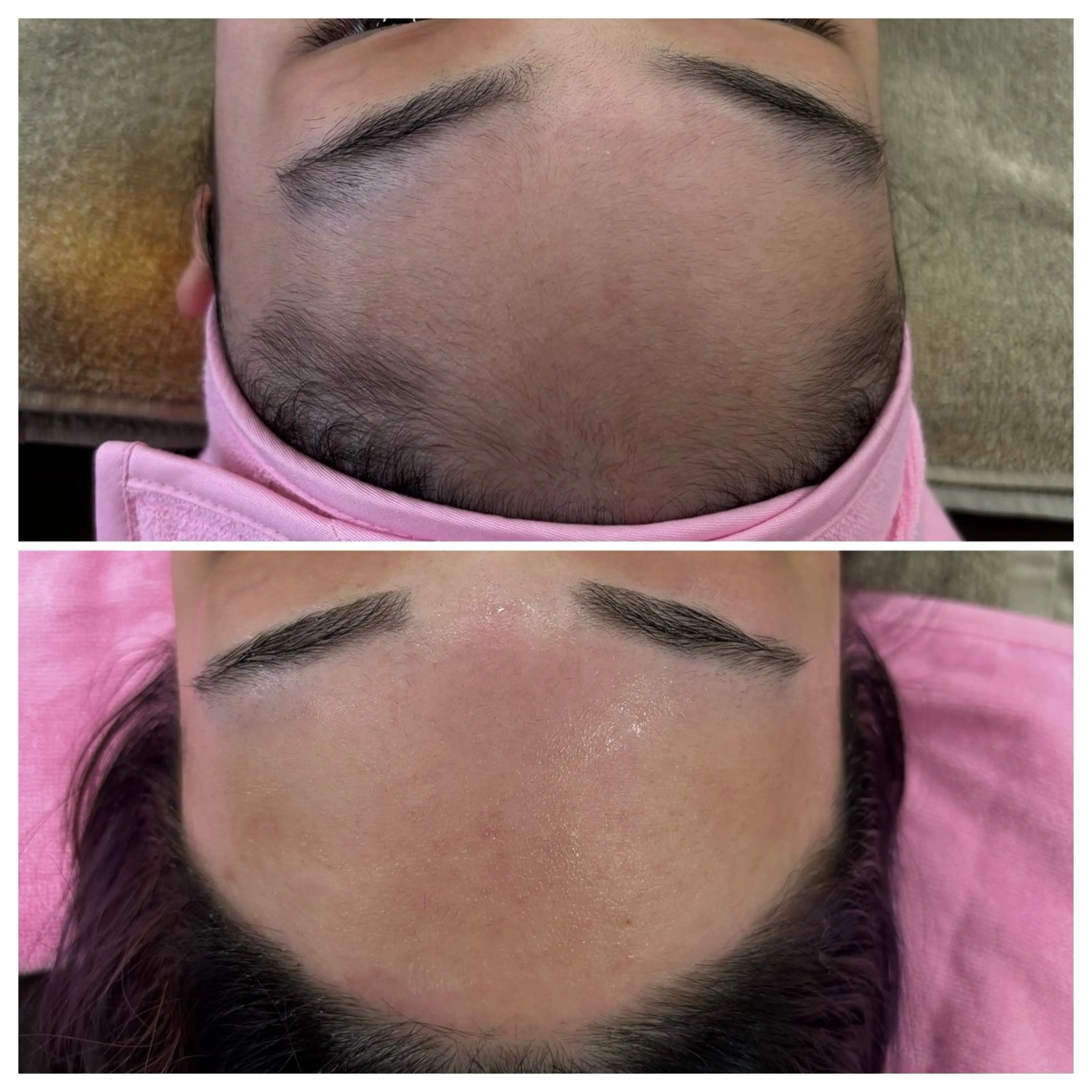 脱毛 TAKAMATSU RINAのネイルデザイン