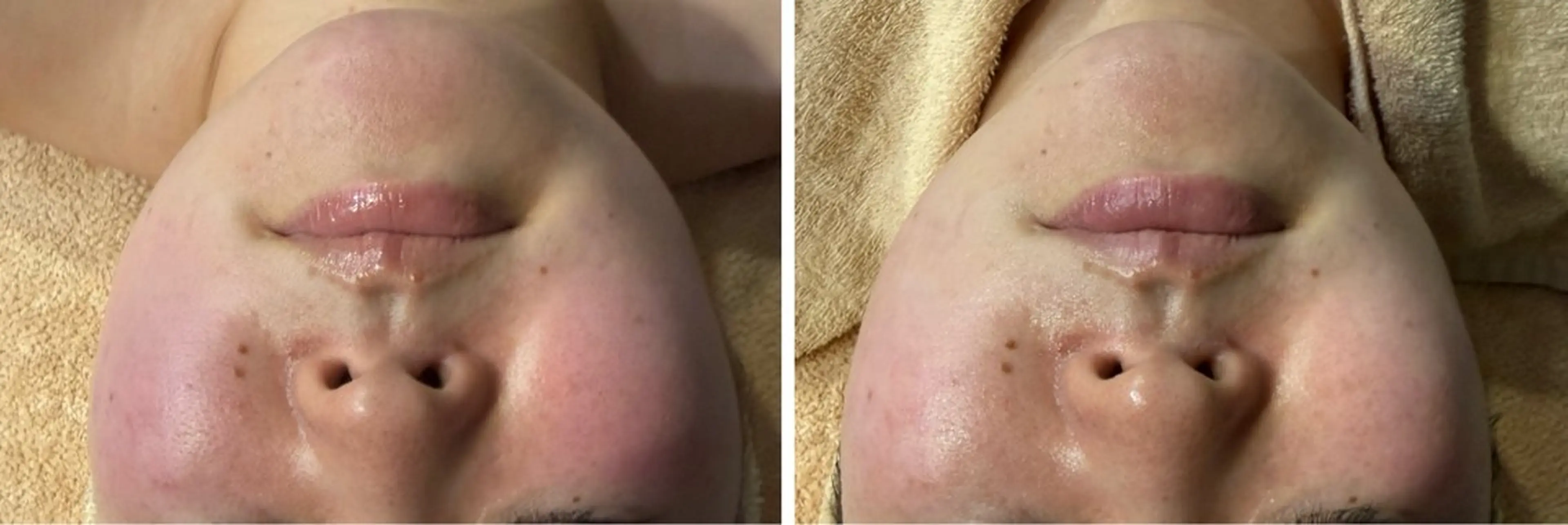 エステ LUARAフェイシャルサロン 新御徒町店所属・ルアラ エステのエステ・リラクイメージ