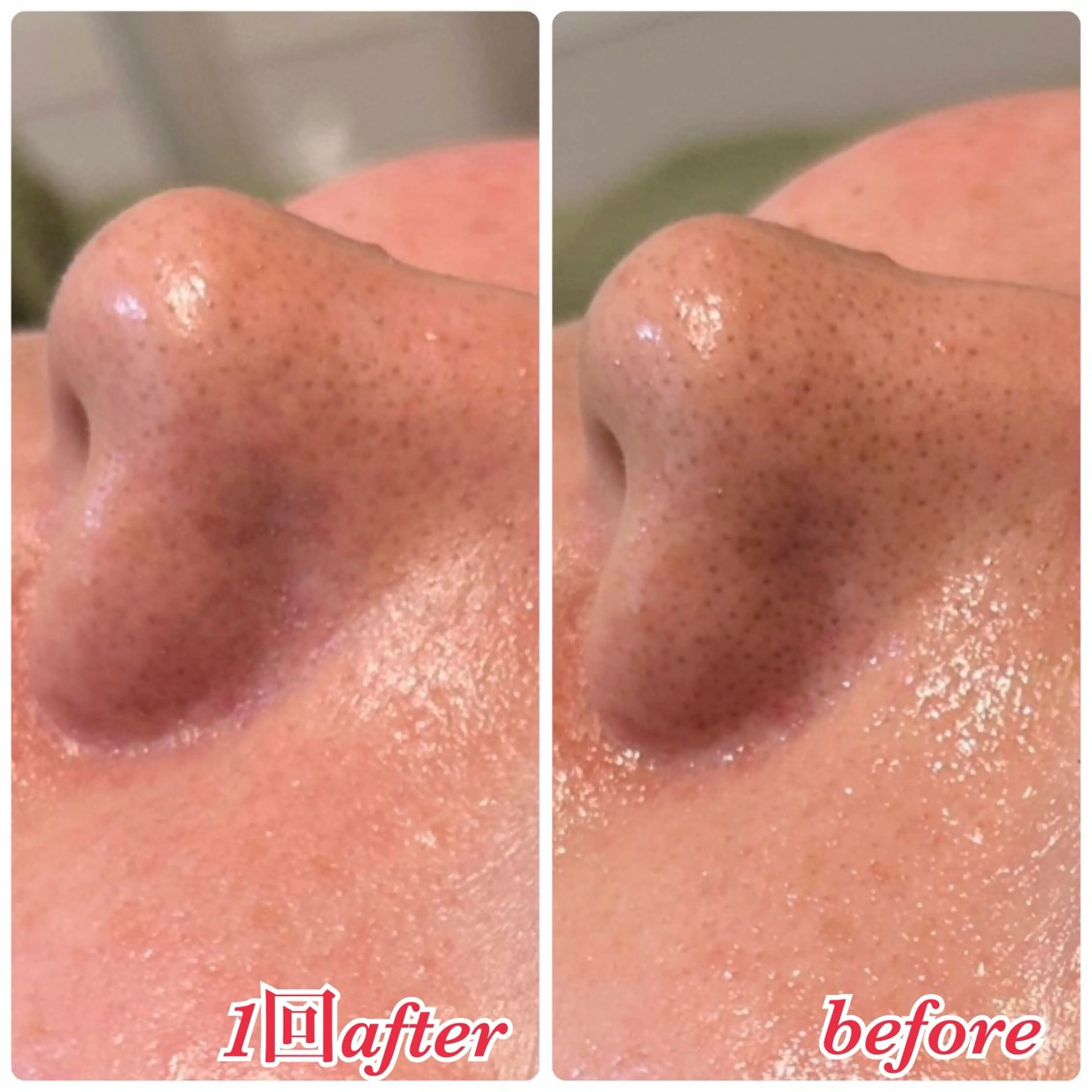 エステ 美ola ビオラのエステ・リラクイメージ