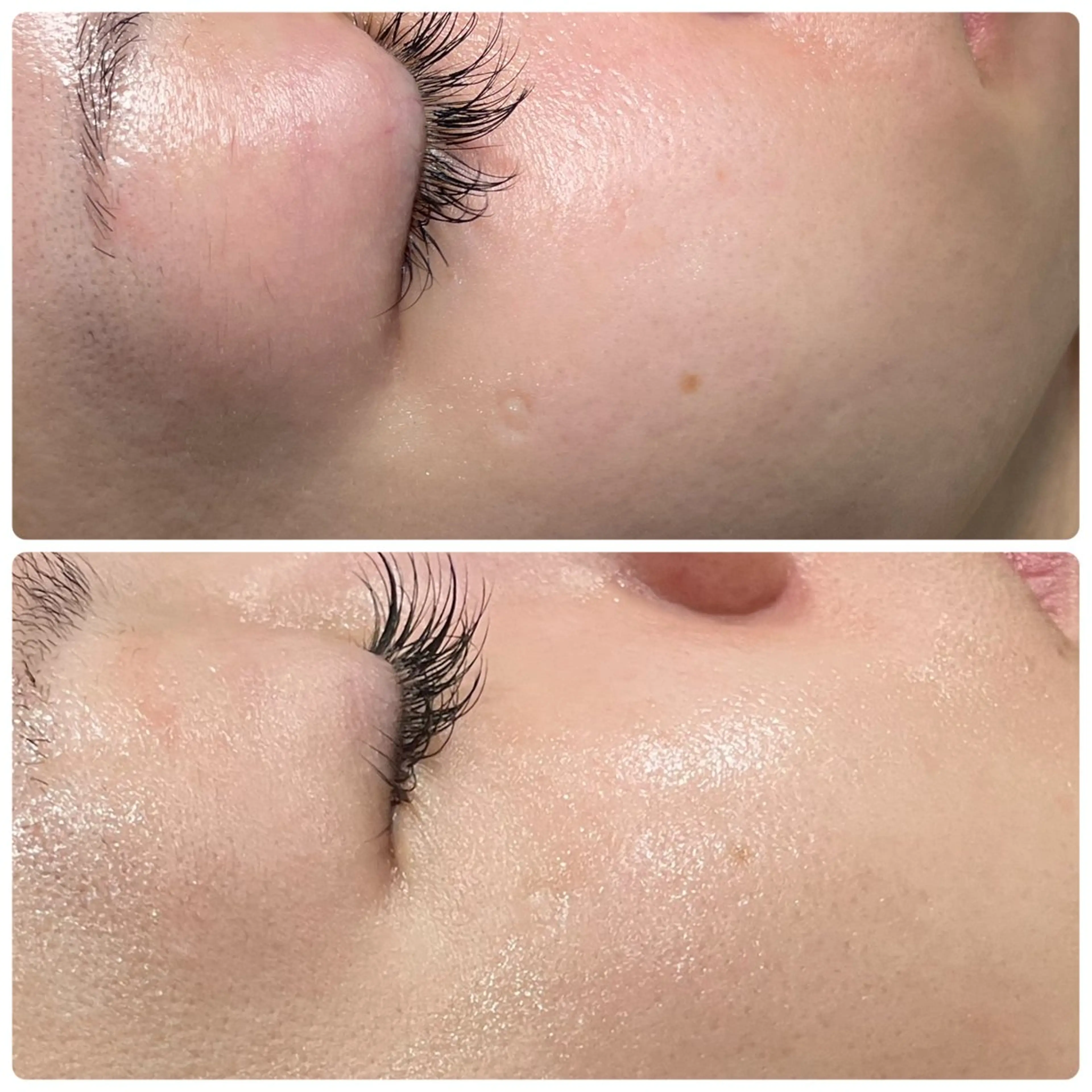 LiZA エステティックサロンのその他イメージ