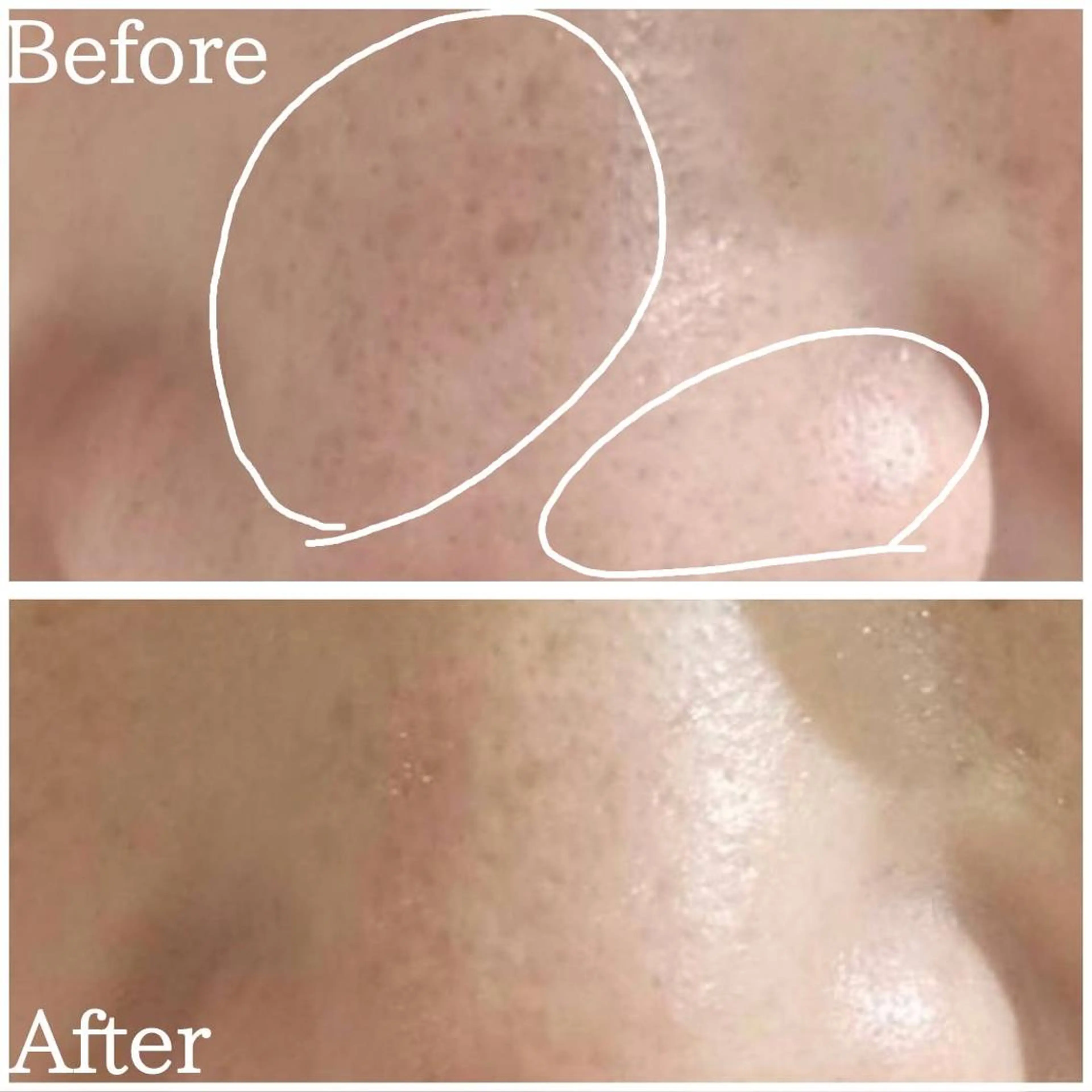 小顔・ツルツル素肌 ハリステリアのエステ・リラクイメージ