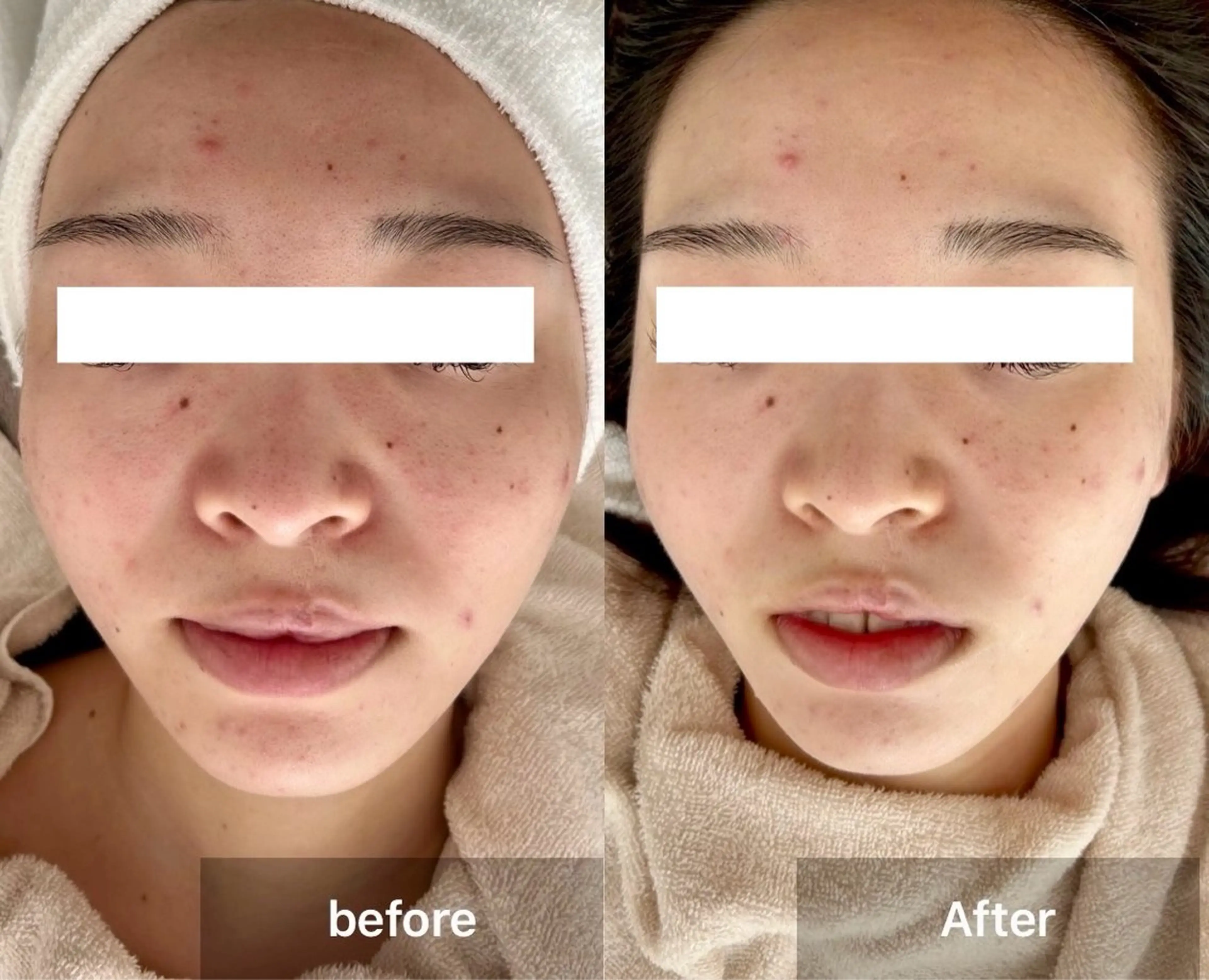 エステ リラク 目元・まつパ・美肌フ ェイシャル谷町四丁目のマツエク・マツパデザイン