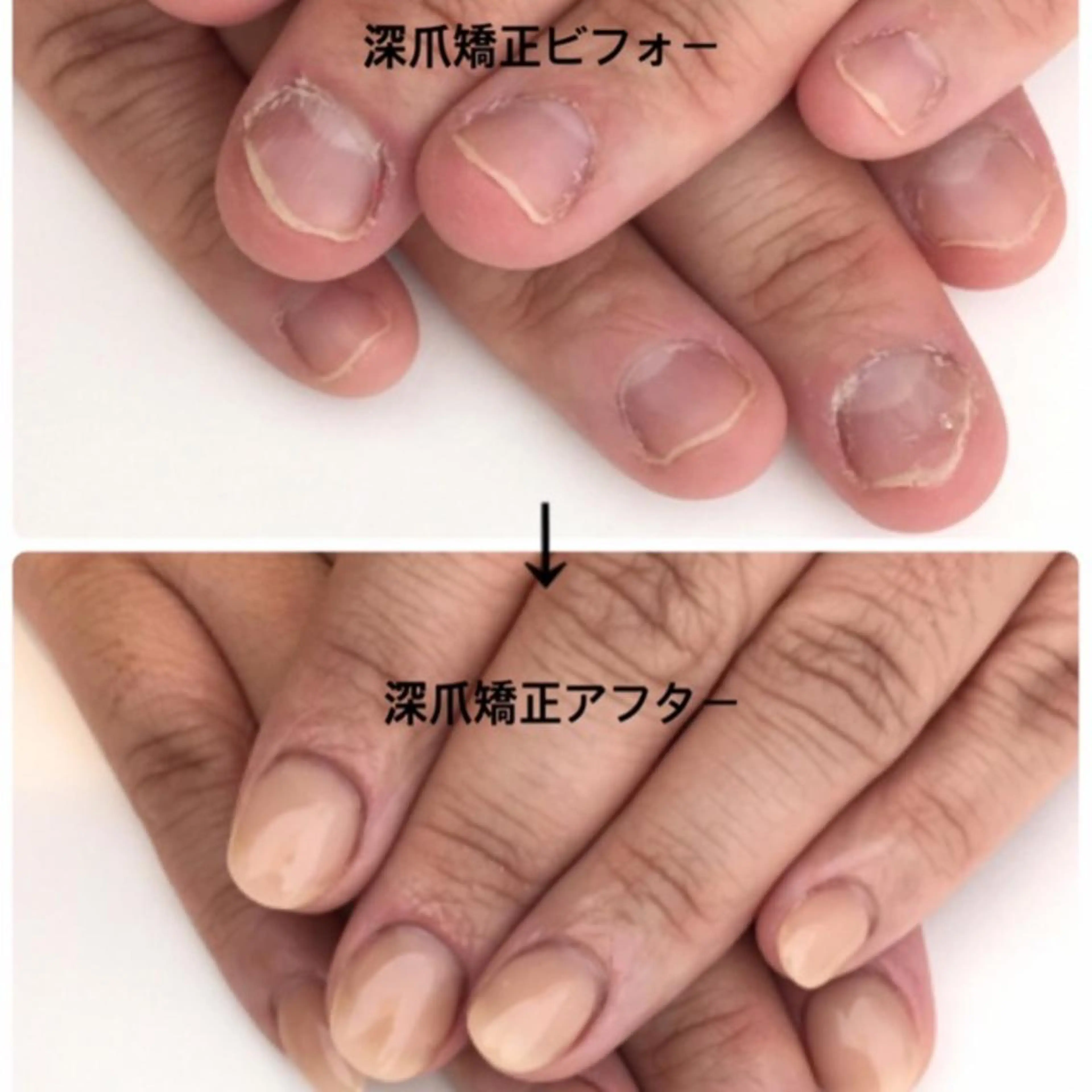 ネイル Alice マツエク&ネイル2のネイルデザイン