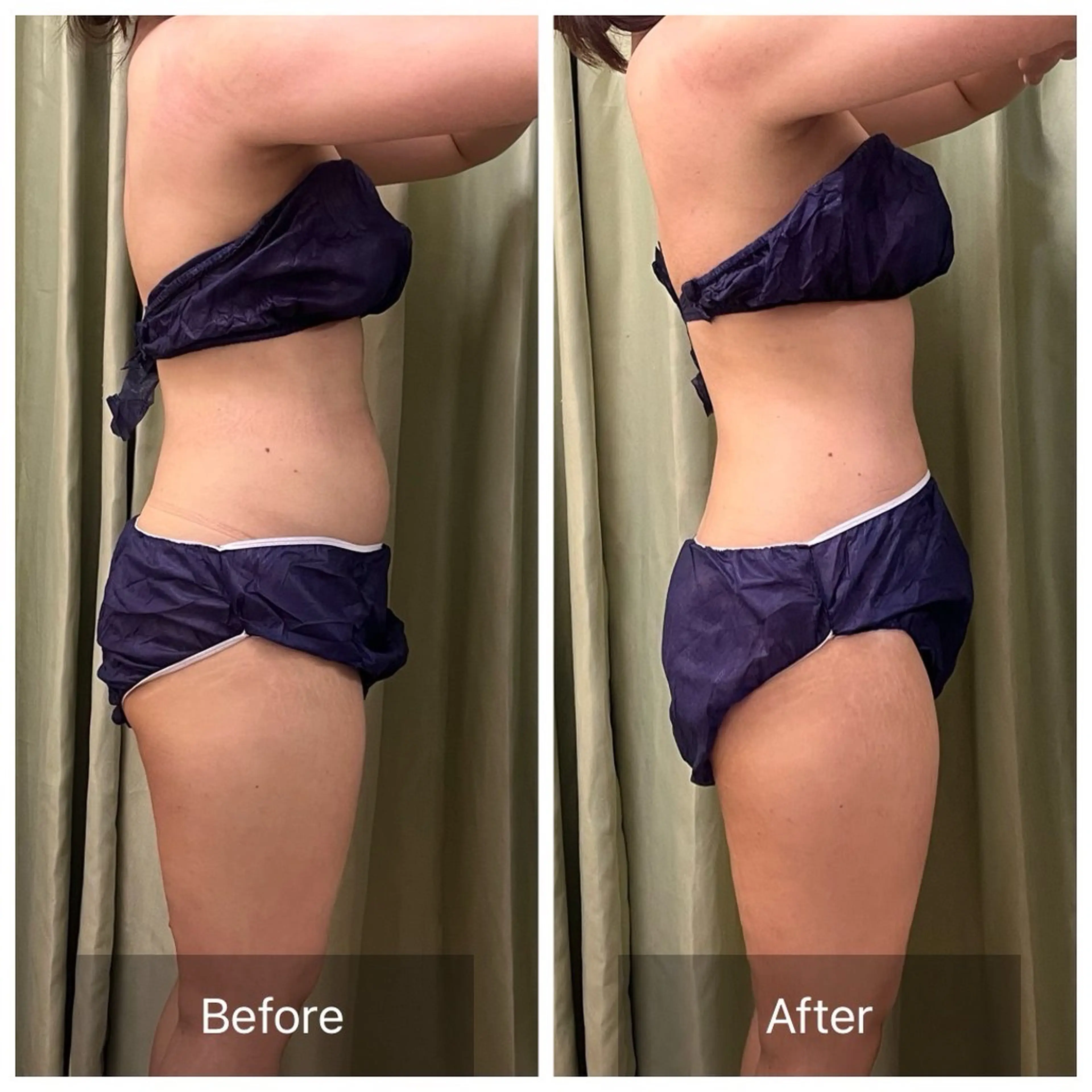 【30分で緩む！】腸セラピー×痩身リンパでお腹周りの悩み解決30分の写真