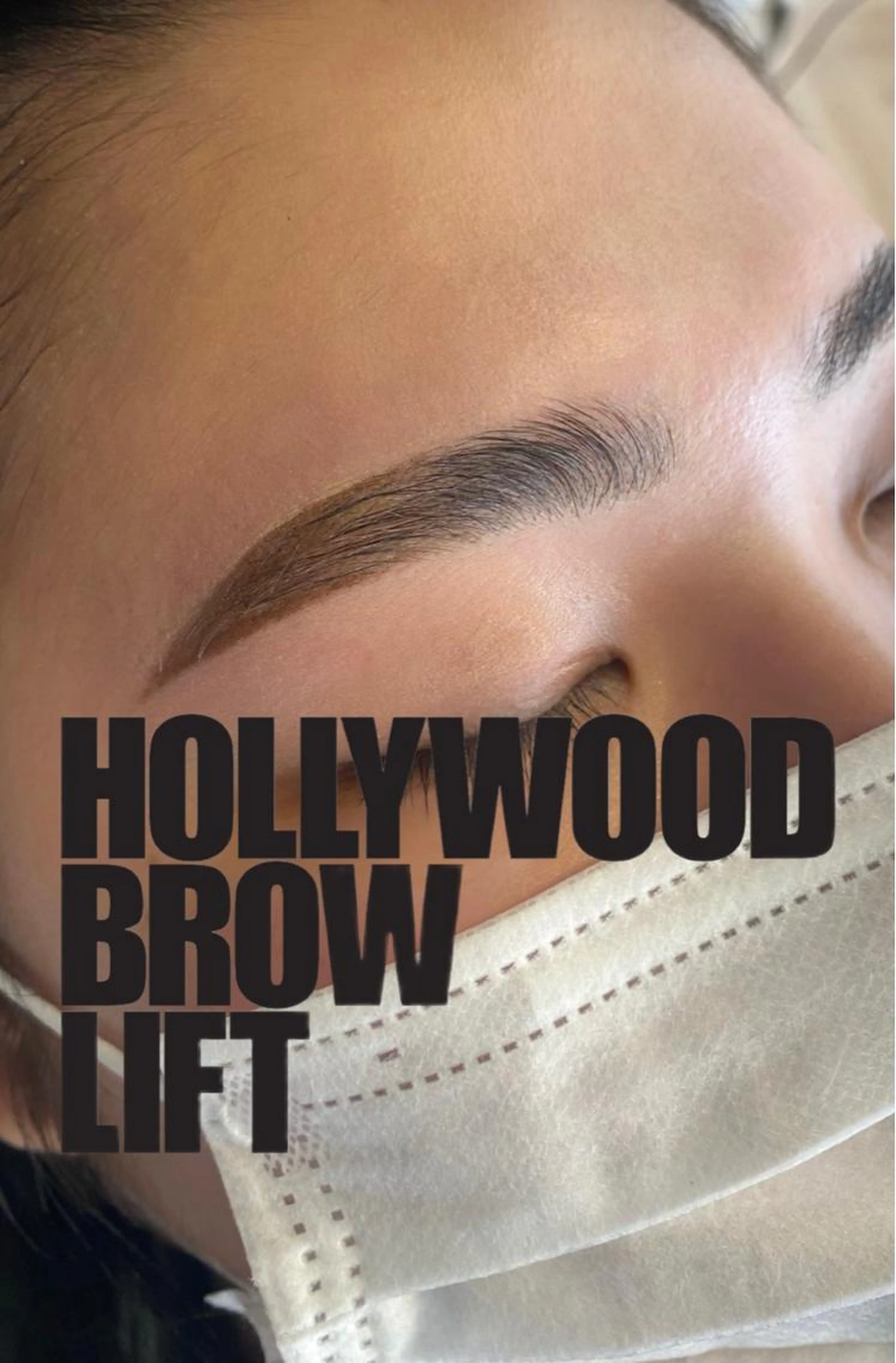 ハリウッドブロウリフト モニターの写真