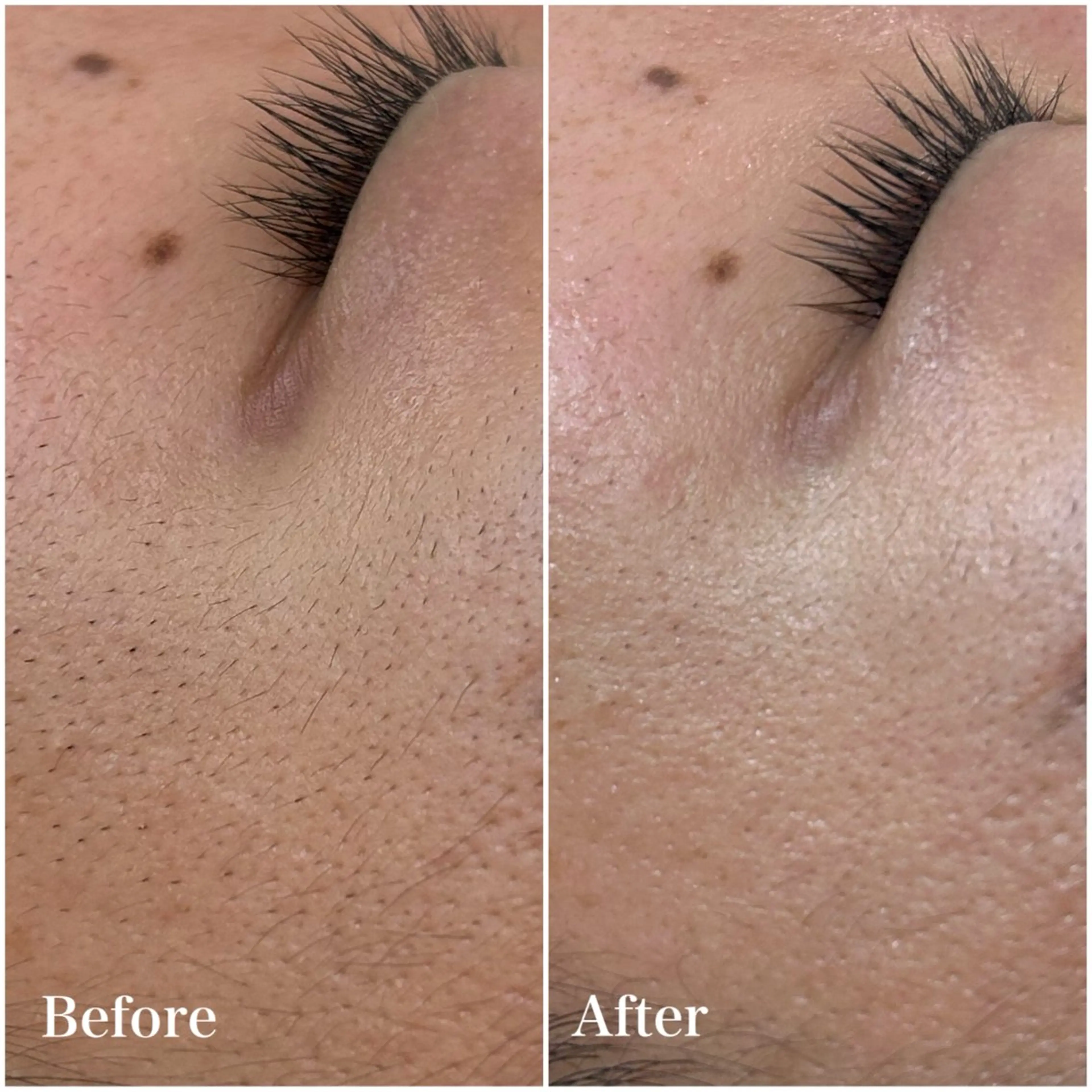 美肌育成専門サロンラクシュミー所属・毛穴肌管理サロン ラクシュミーのエステ・リラクイメージ