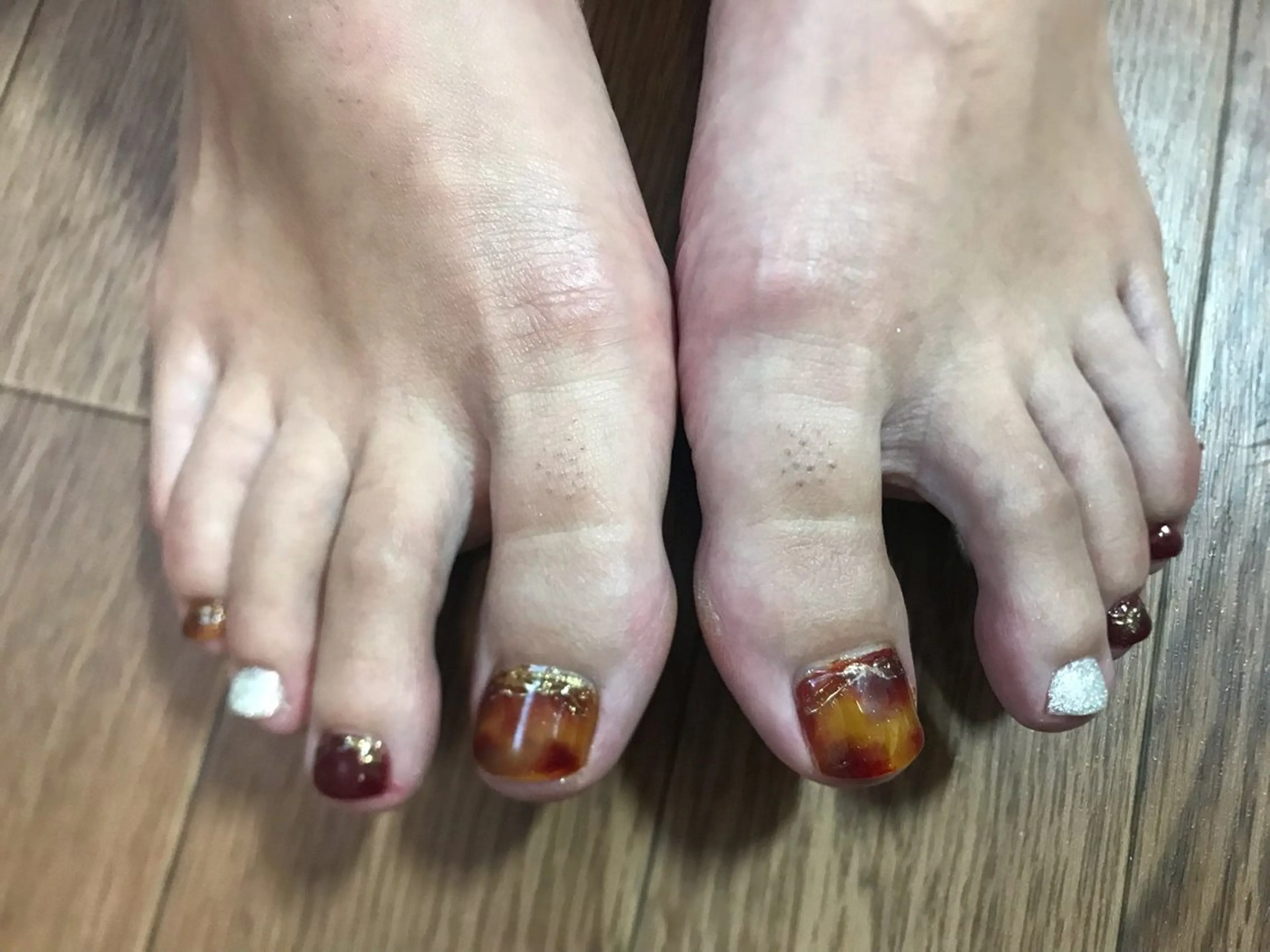 ネイル フットネイル Nailist Missaのネイルデザイン