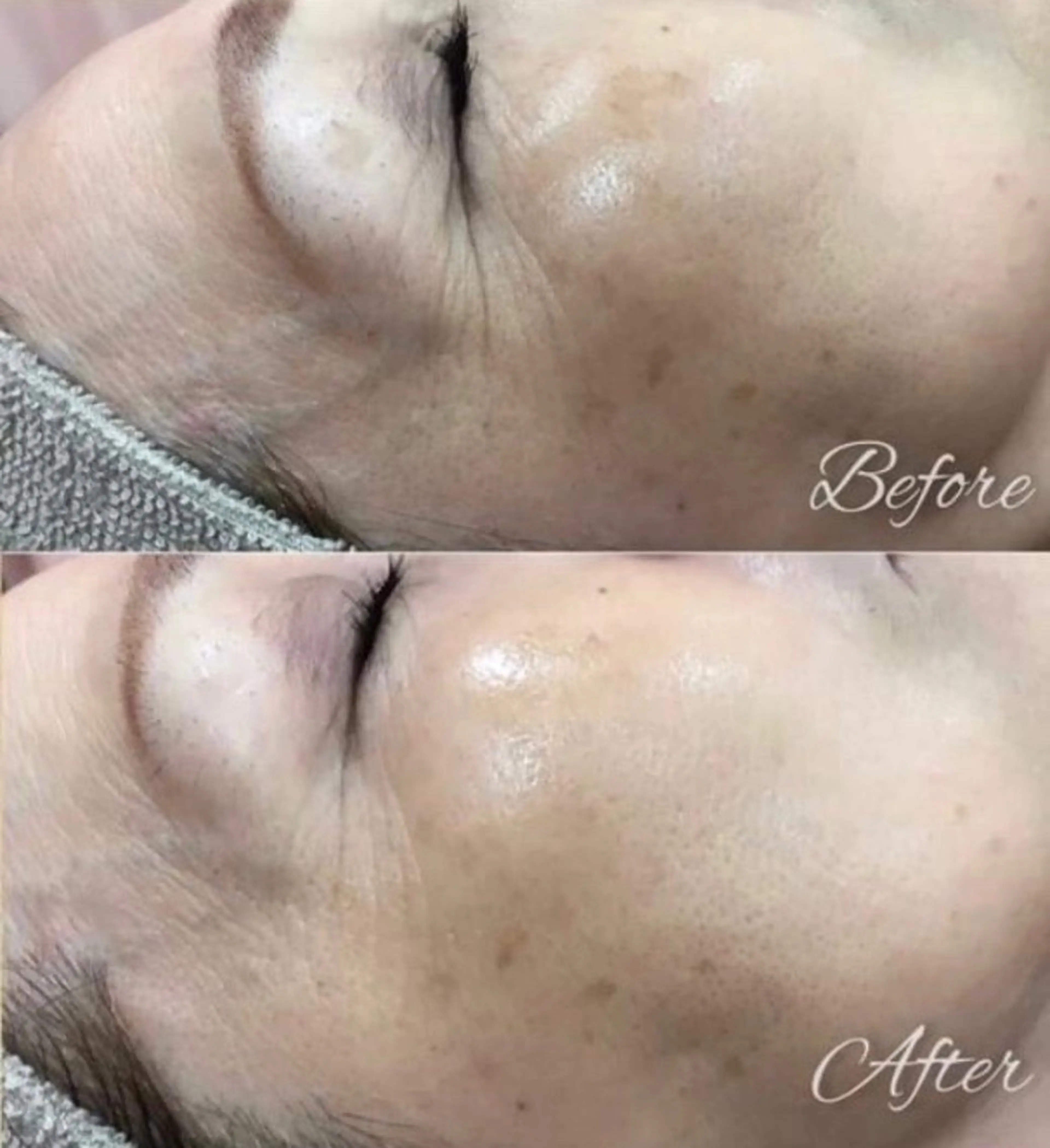 アルカンジュ~archange~所属・痩身/毛穴洗浄/脱毛 アルカンジュのエステ・リラクイメージ