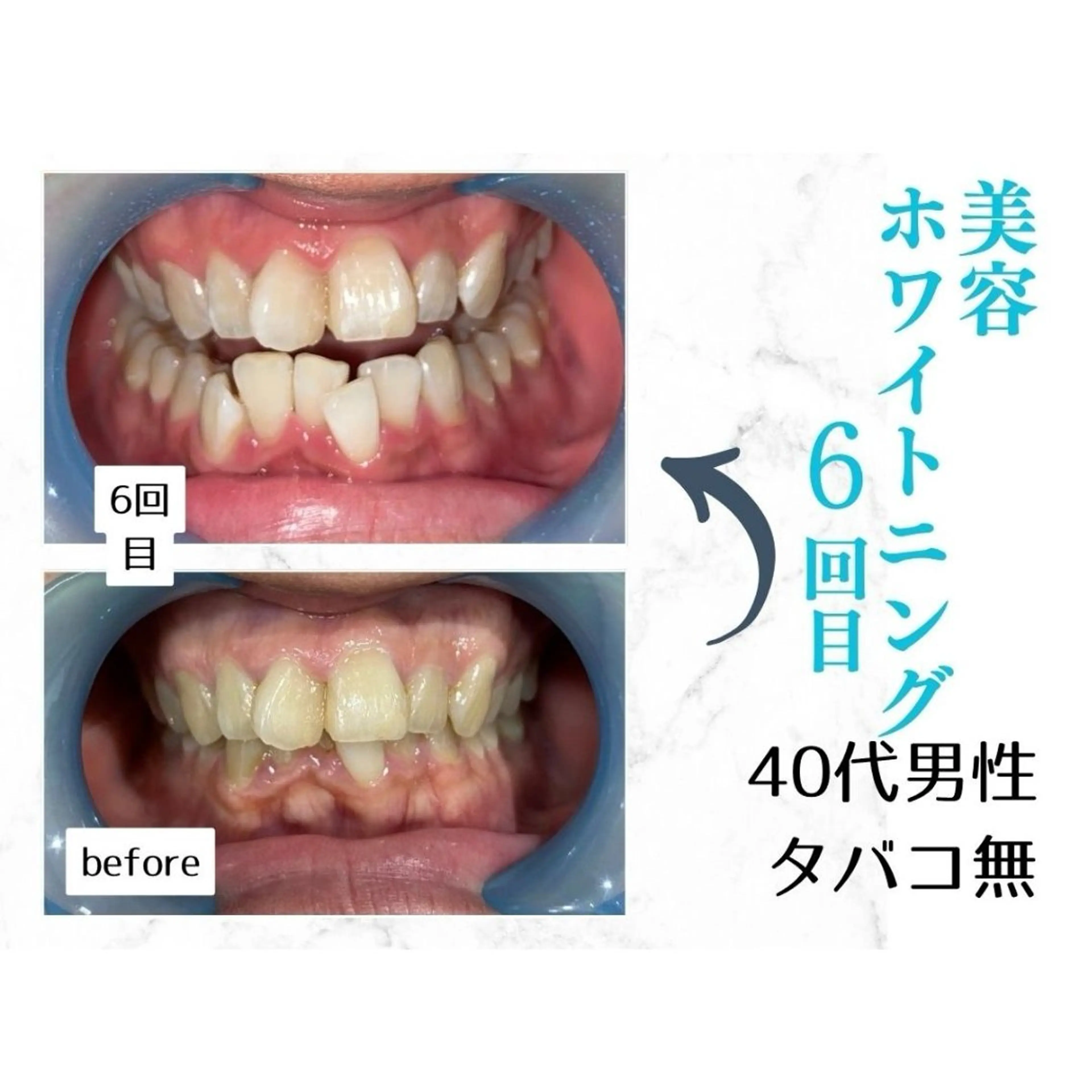 ホワイトニングサロン le  canonのその他イメージ