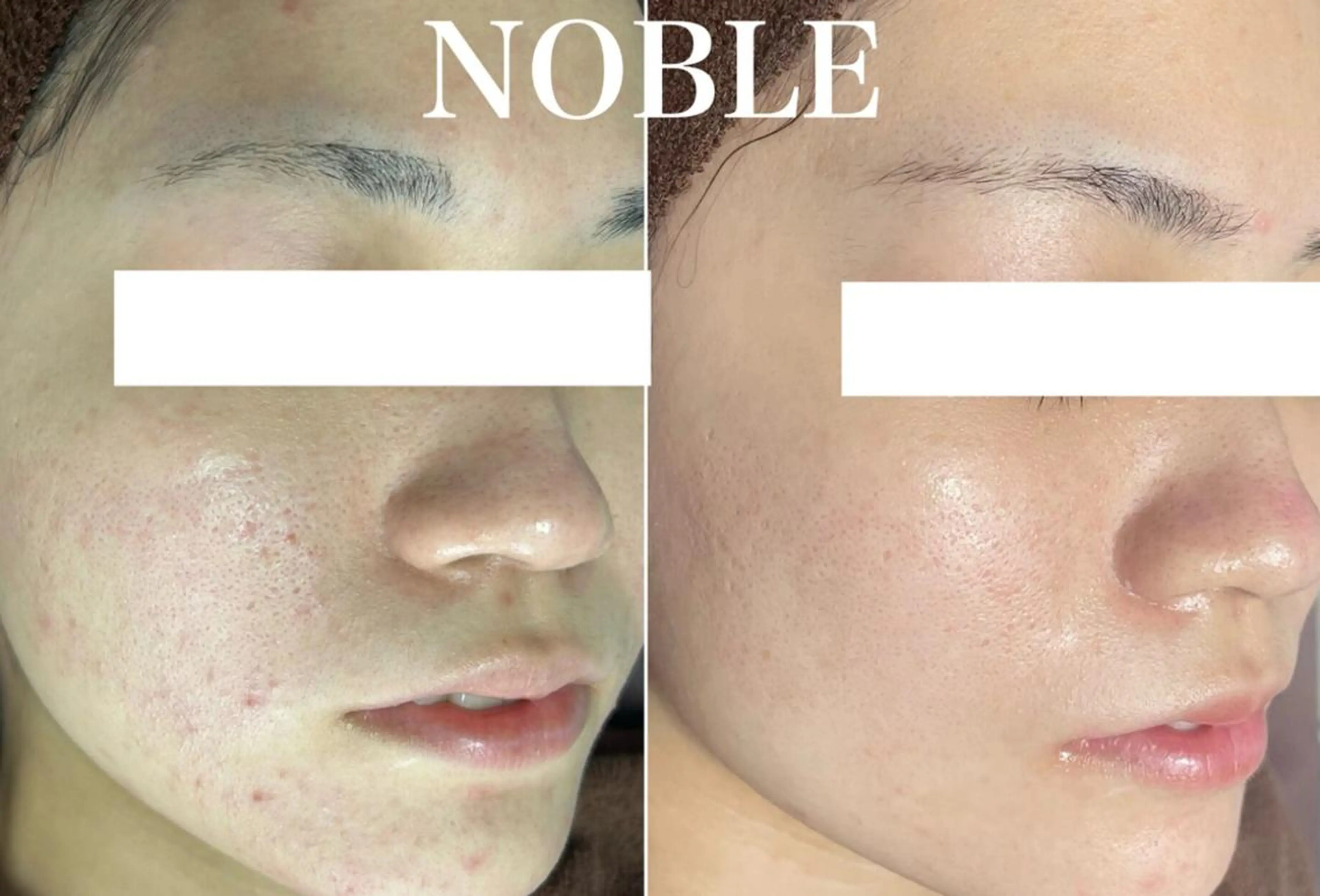 NOBLE 新宿南口店のエステ・リラクイメージ