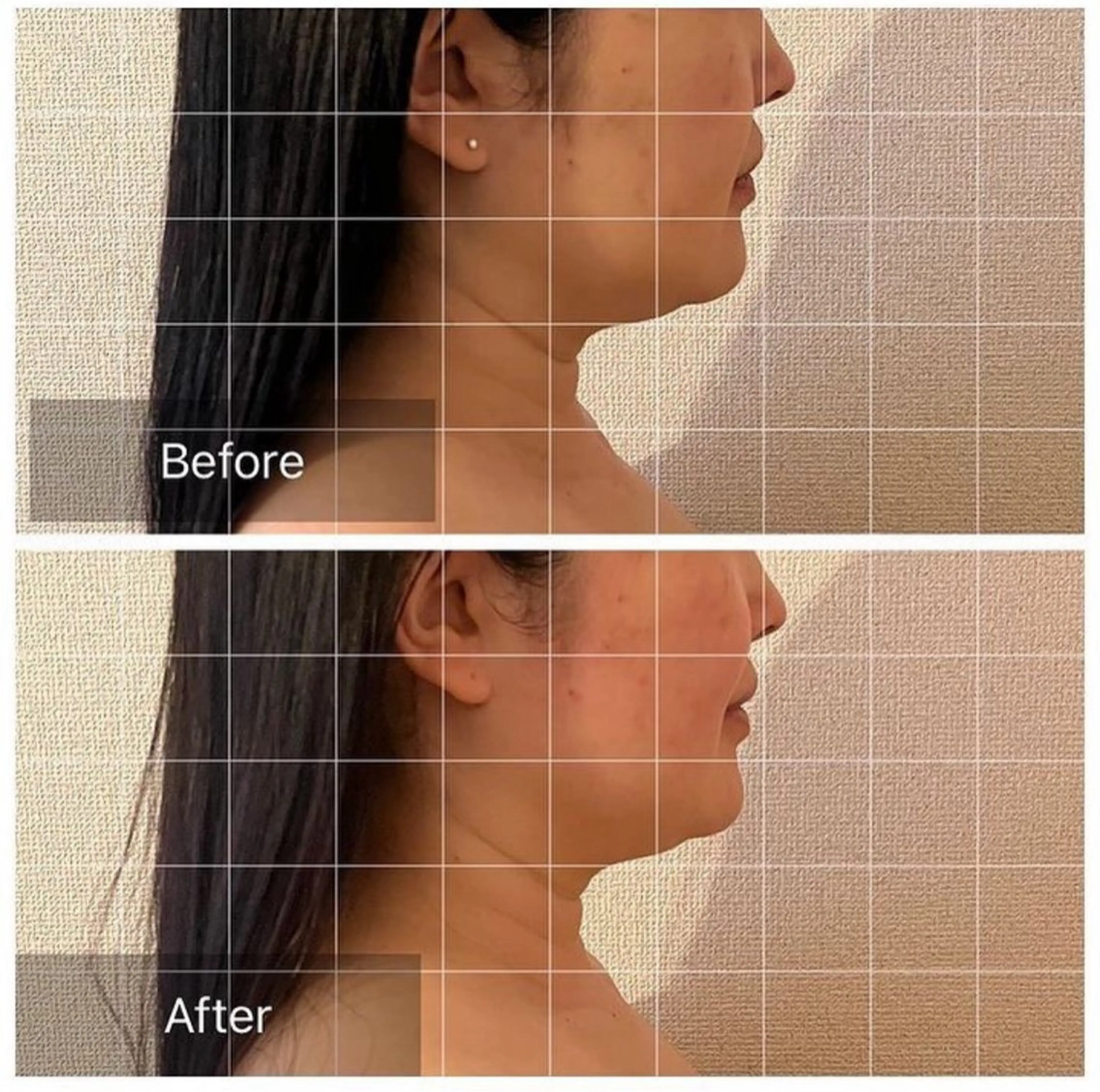 エステ リラク 表情筋フェイシャル 三軒茶屋のエステ・リラクイメージ