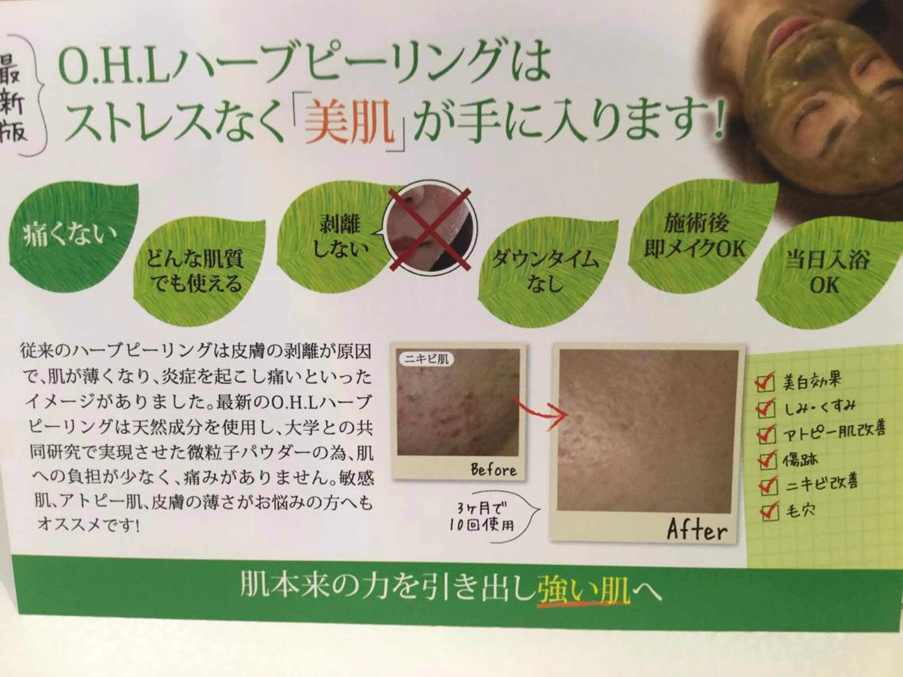 エステ 【リベルハーブピーリング認定店】敏感肌・美白脱毛専門店Dione立川店所属・Dione 立川店のエステ・リラクイメージ