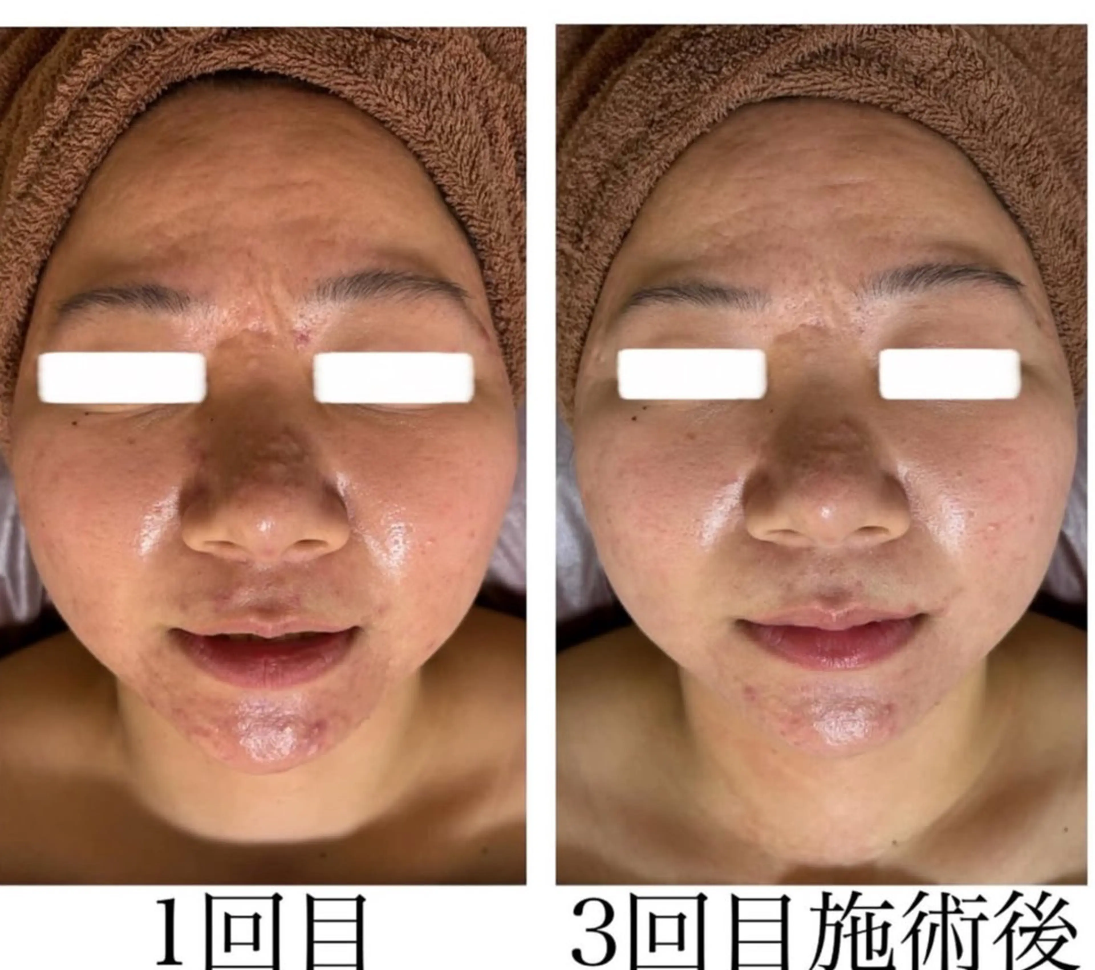 ネイル&エステ phuan(プアン)のネイルデザイン