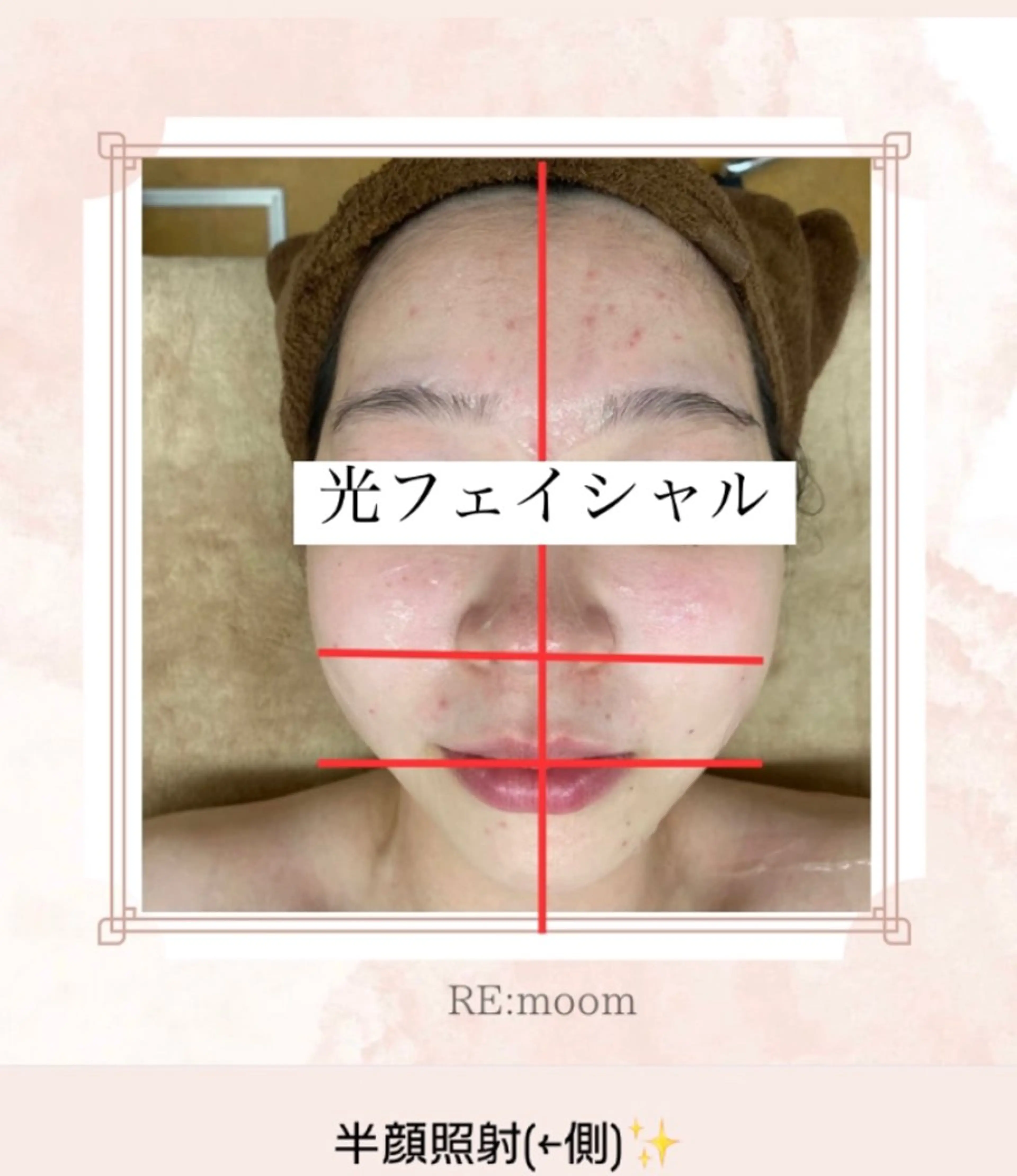 RE:moom リムーム/脱毛エステのエステ・リラクイメージ