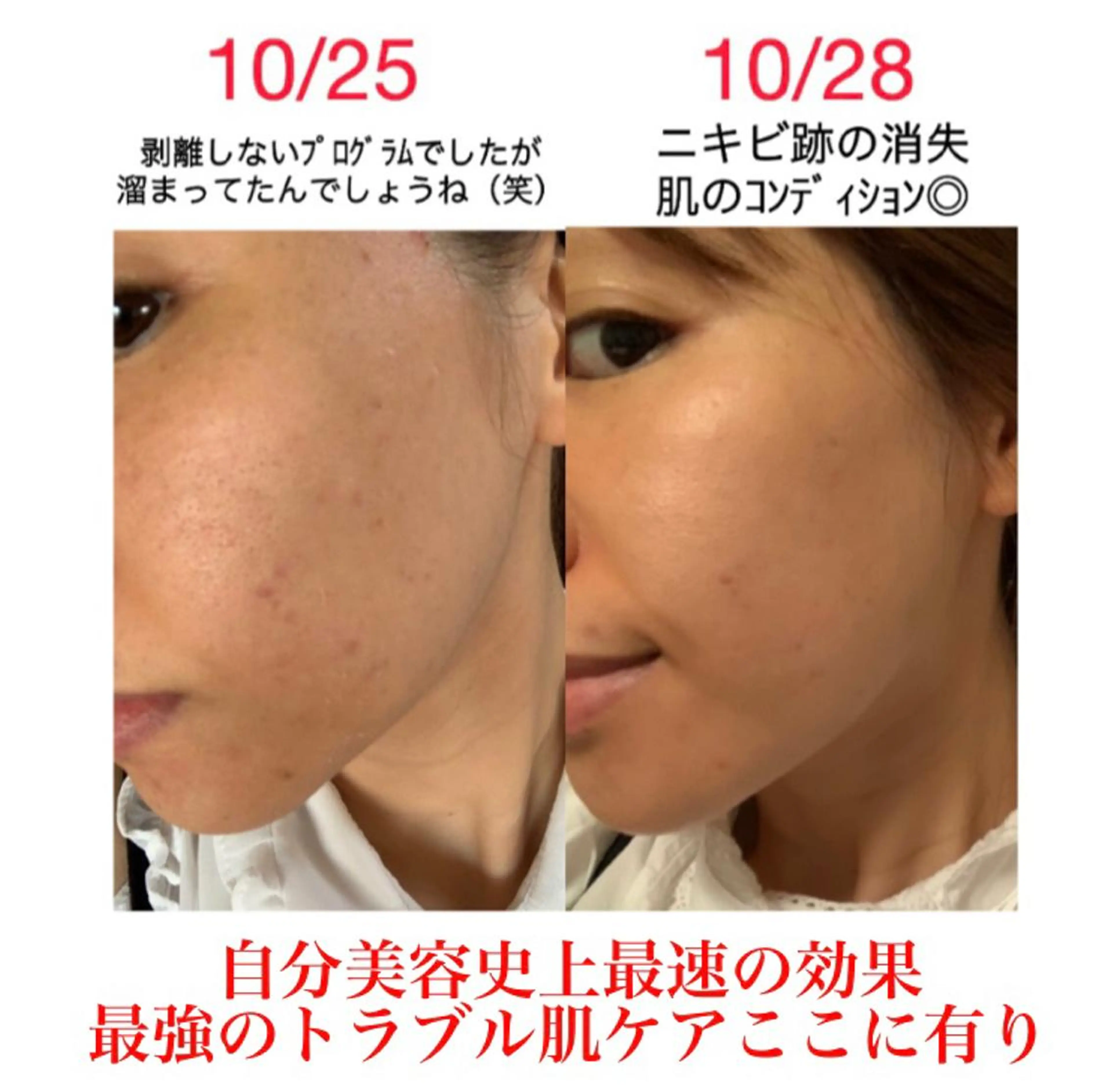 a  room salonのエステ・リラクイメージ