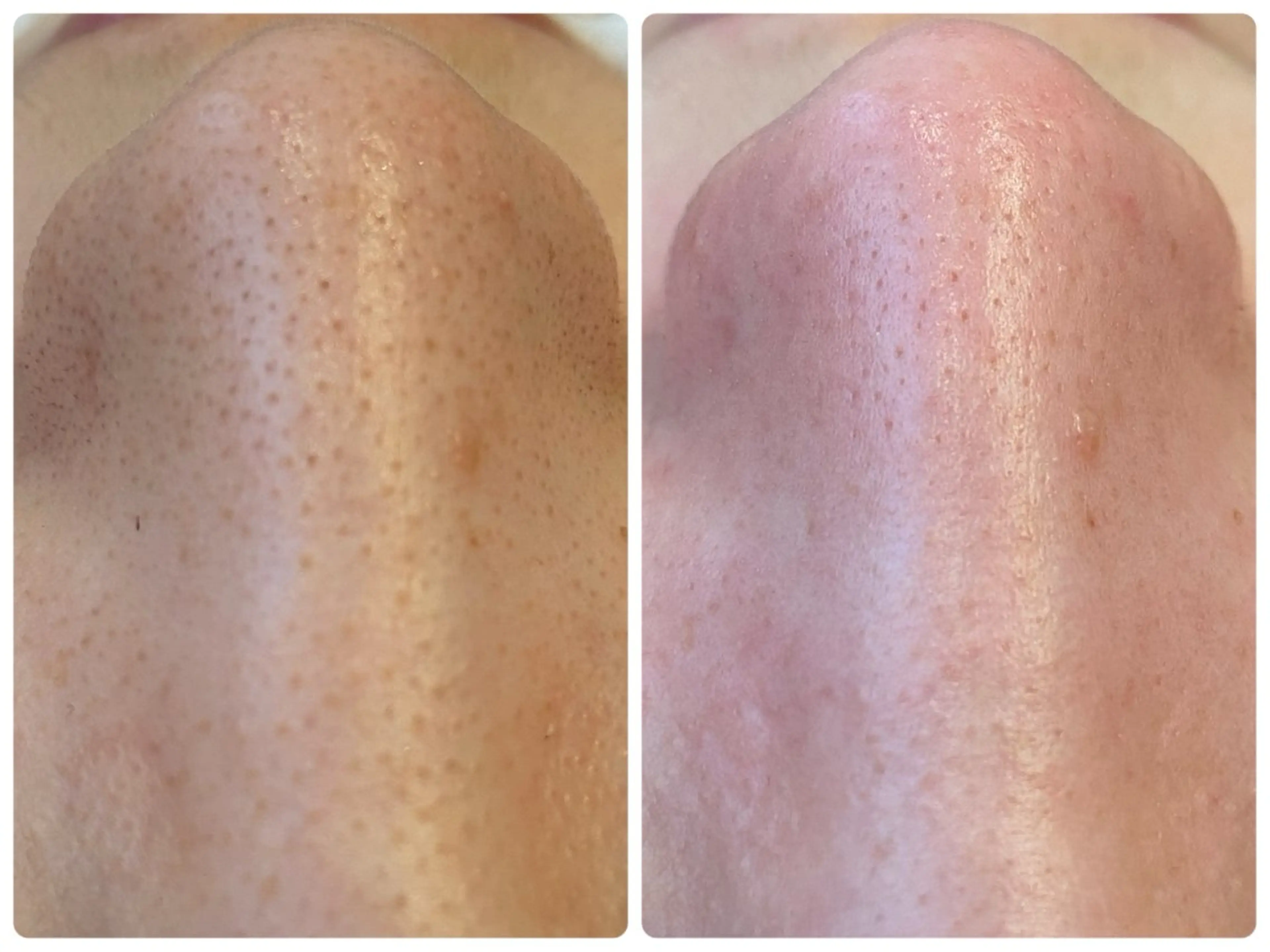 Hisui 小出のエステ・リラクイメージ