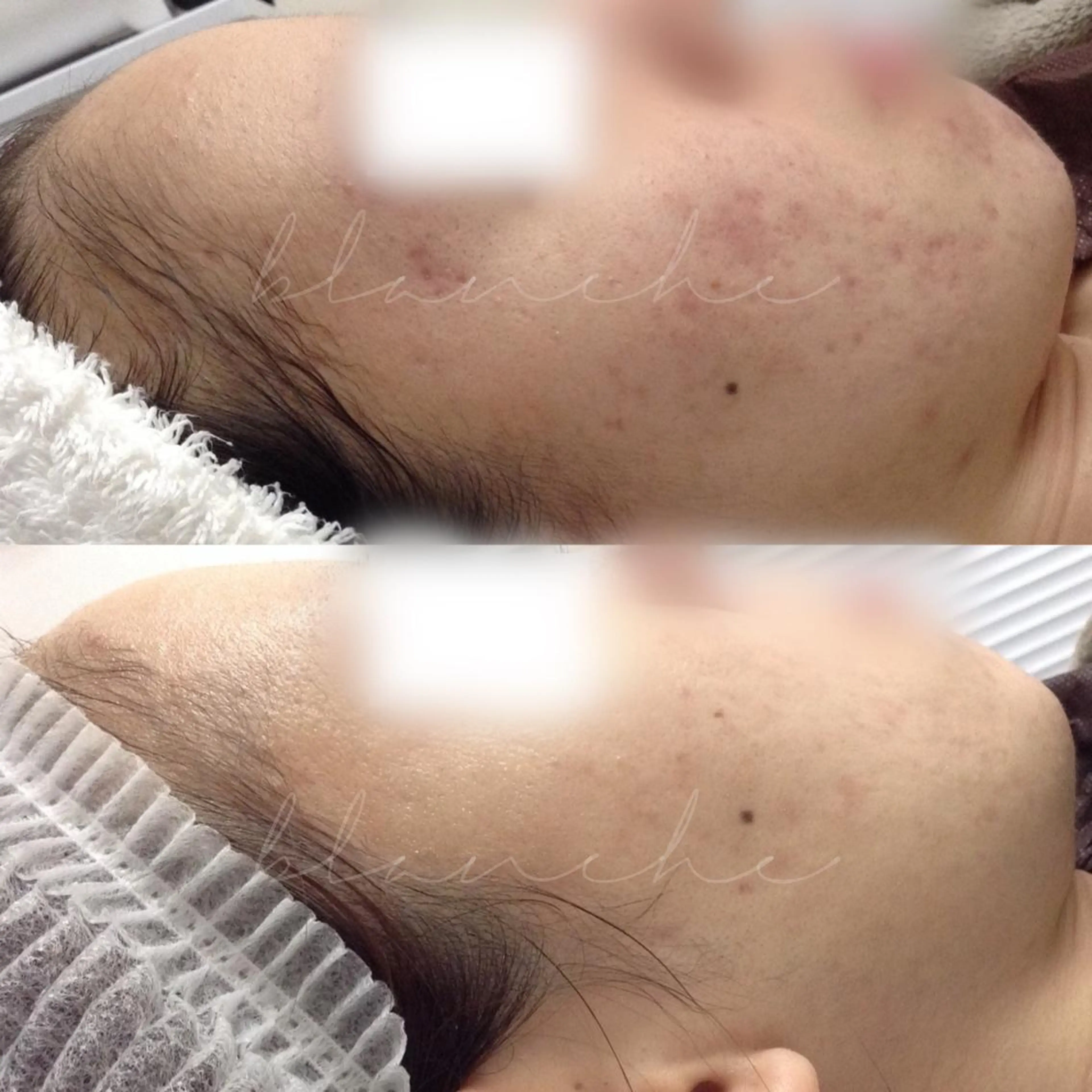 ミディアム カラー パーマ ヘアアレンジ ネイル マツエク・マツパ アイブロウ エステ リラク 都度払い肌質改善 &脱毛Blancheのエステ・リラクイメージ