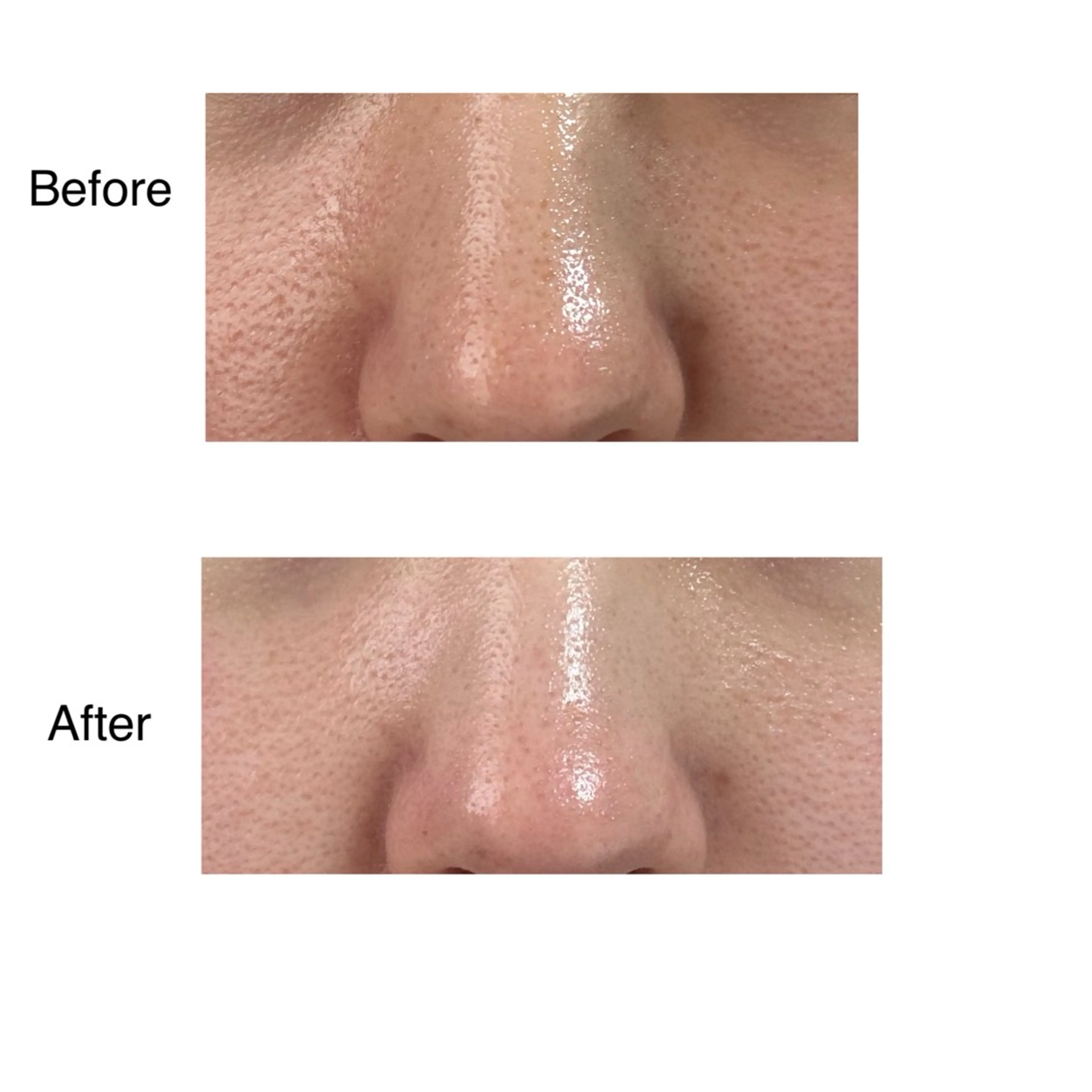 エステ ROR所属・ROR Nanaのネイルデザイン