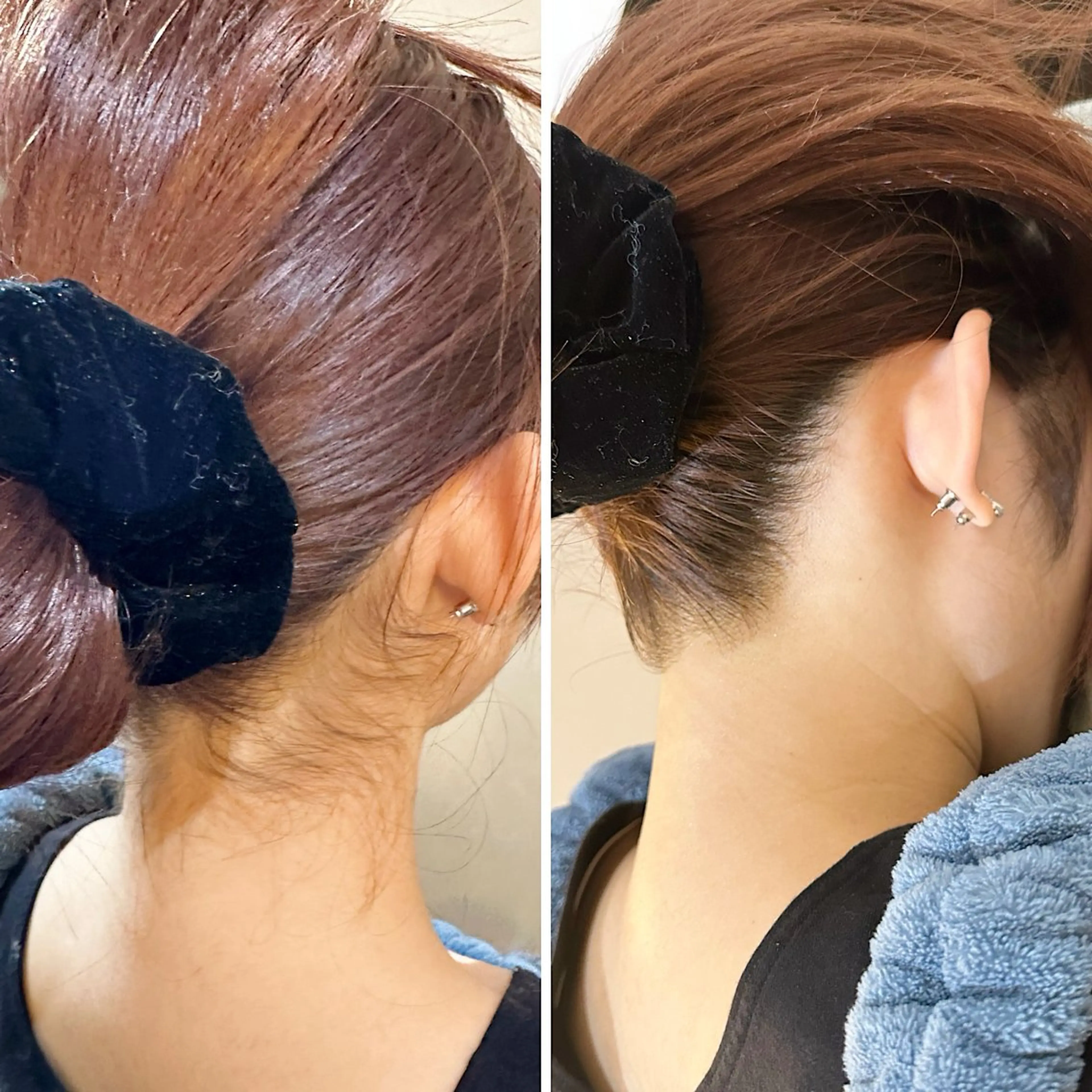 脱毛 うなじ脱毛/美肌脱毛 LABELのエステ・リラクイメージ