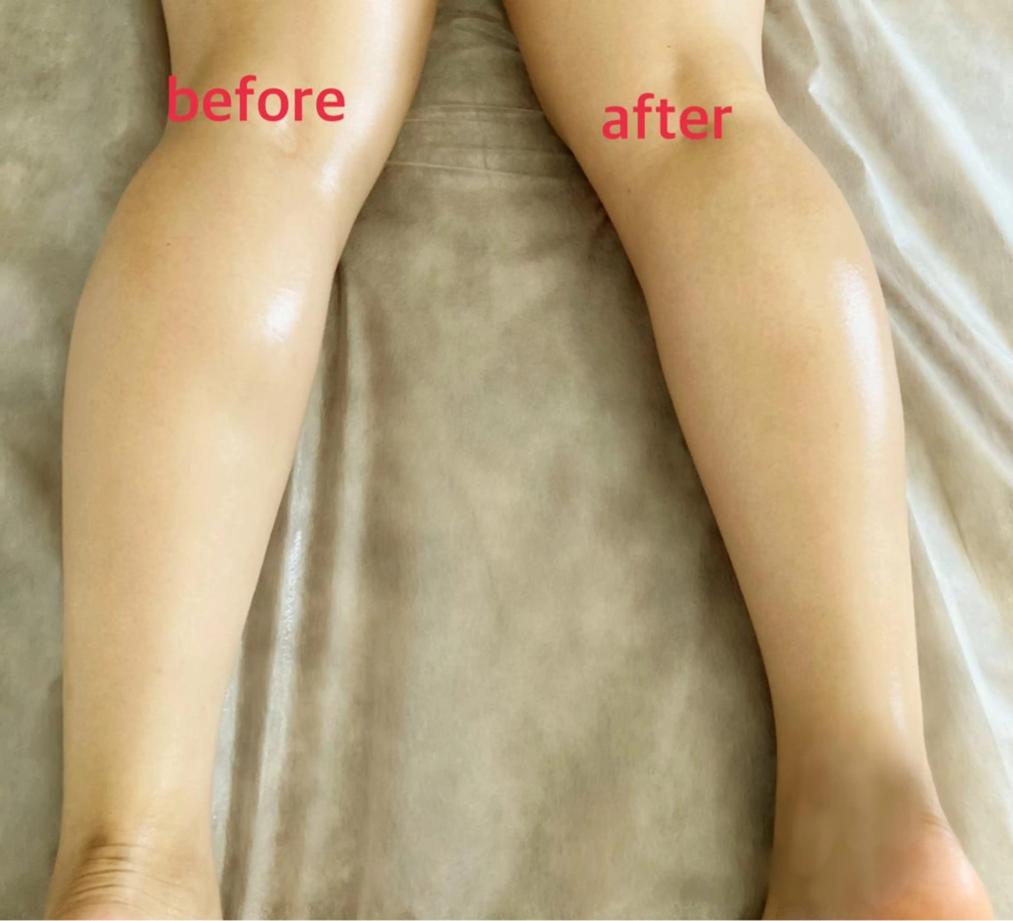 bellissimo 【ベリッシモ】所属・ちひろ　痩身/ハーブ bellissimoのエステ・リラクイメージ