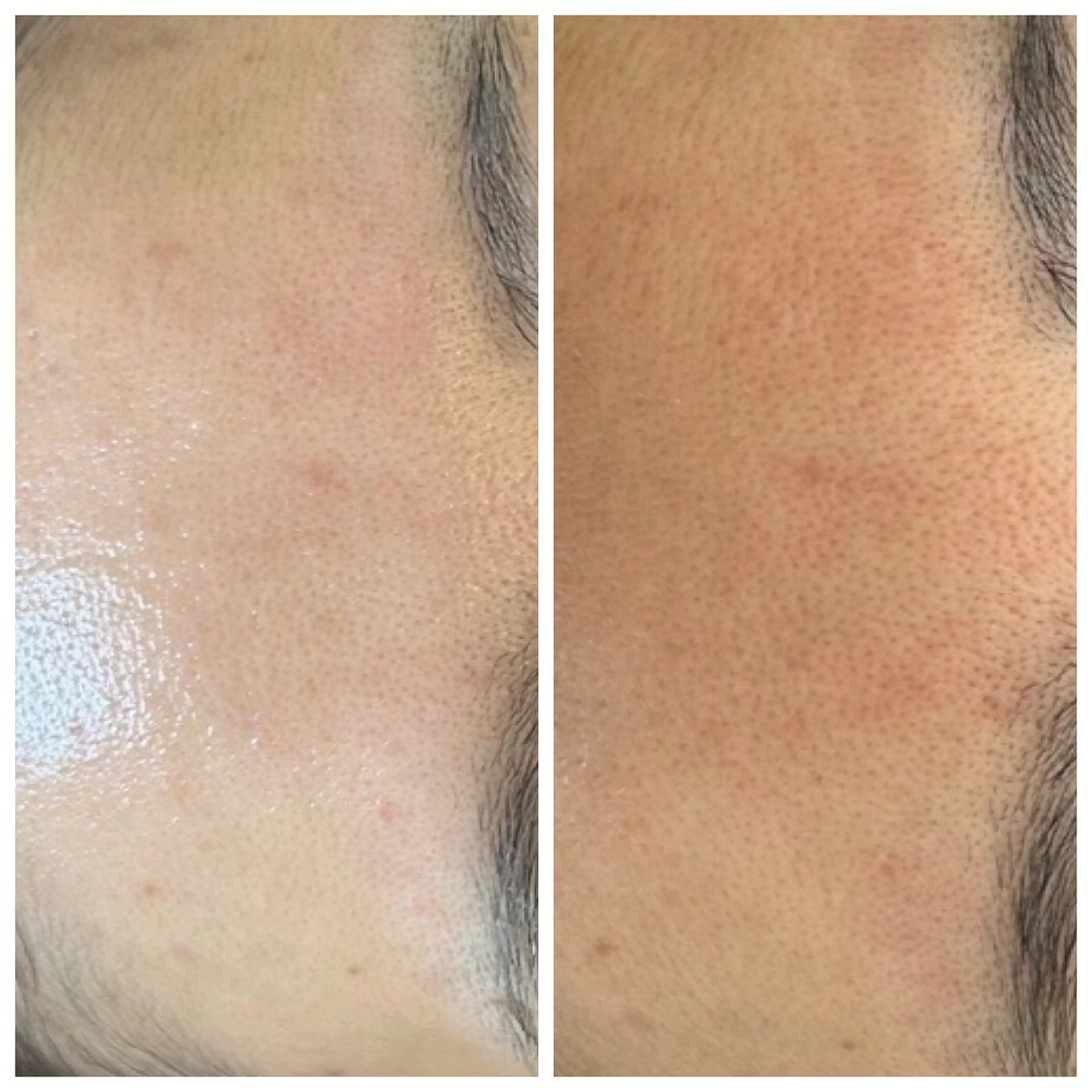 le'aroom所属・ＶaＲi ヴァリのエステ・リラクイメージ