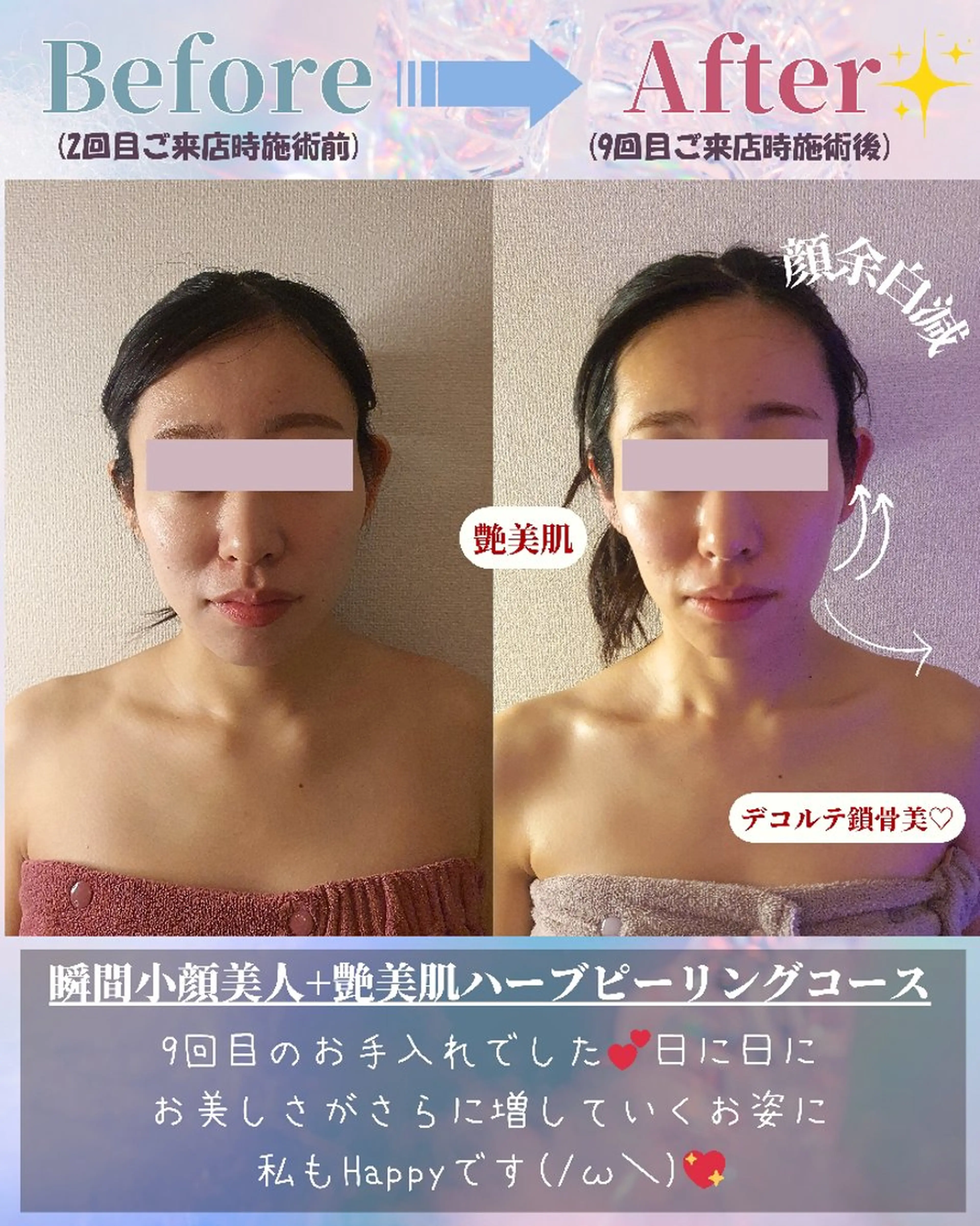 エステ リラク 痩身ハーブピーリング 筋膜リリース☆B&Hのエステ・リラクイメージ