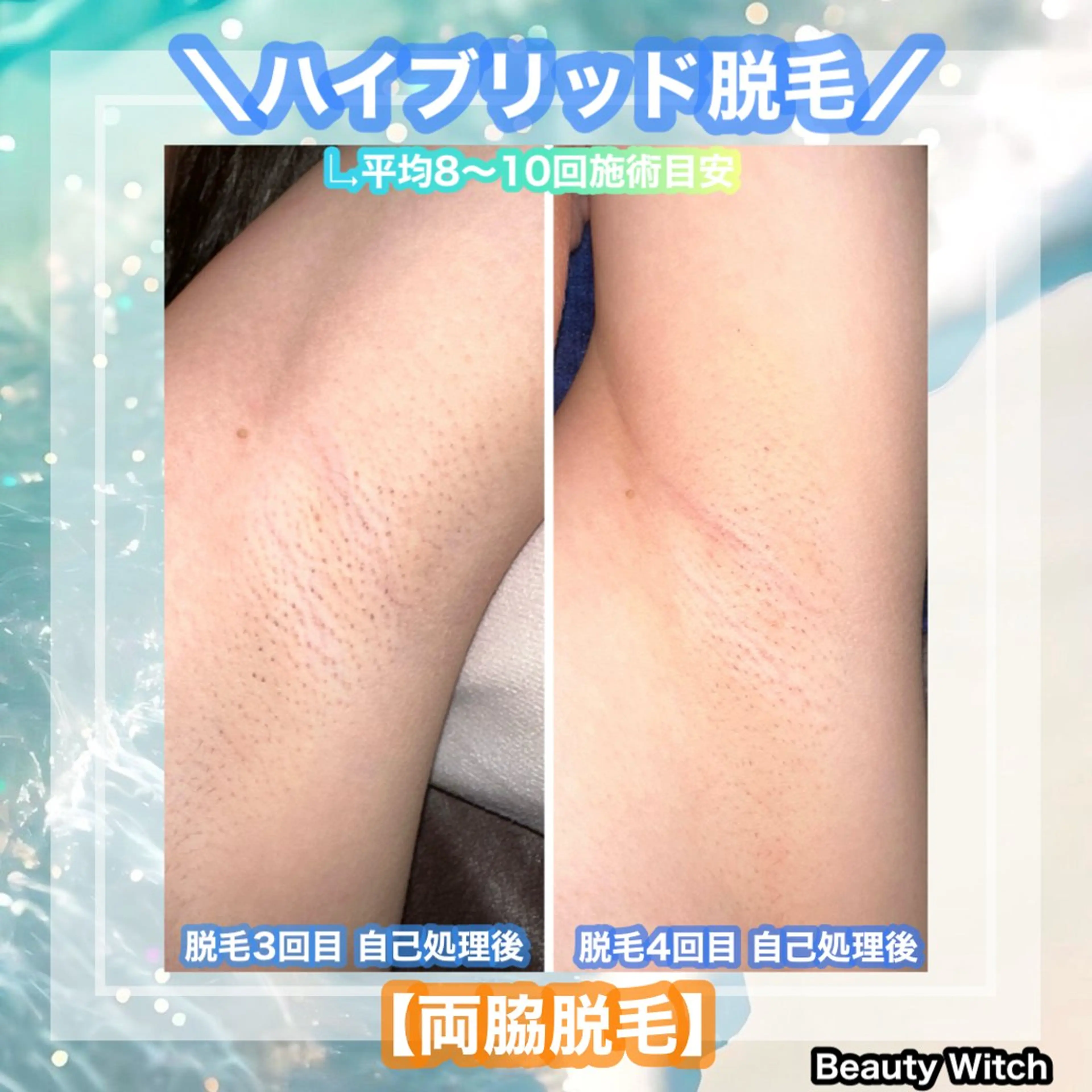 脱毛 痩身/脱毛/ネイル HARUKAのエステ・リラクイメージ