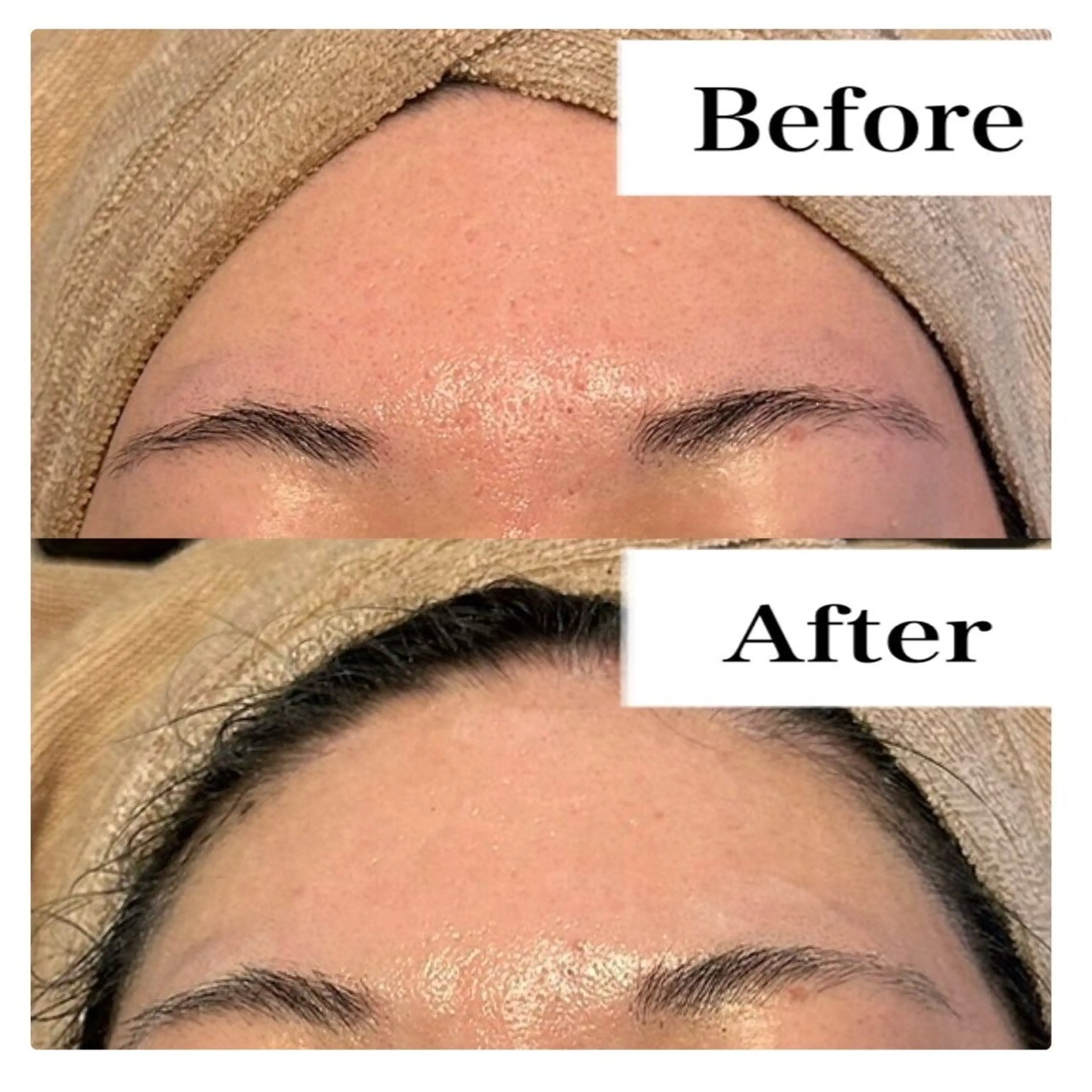 ハーブピーリング LIME池袋東口のエステ・リラクイメージ