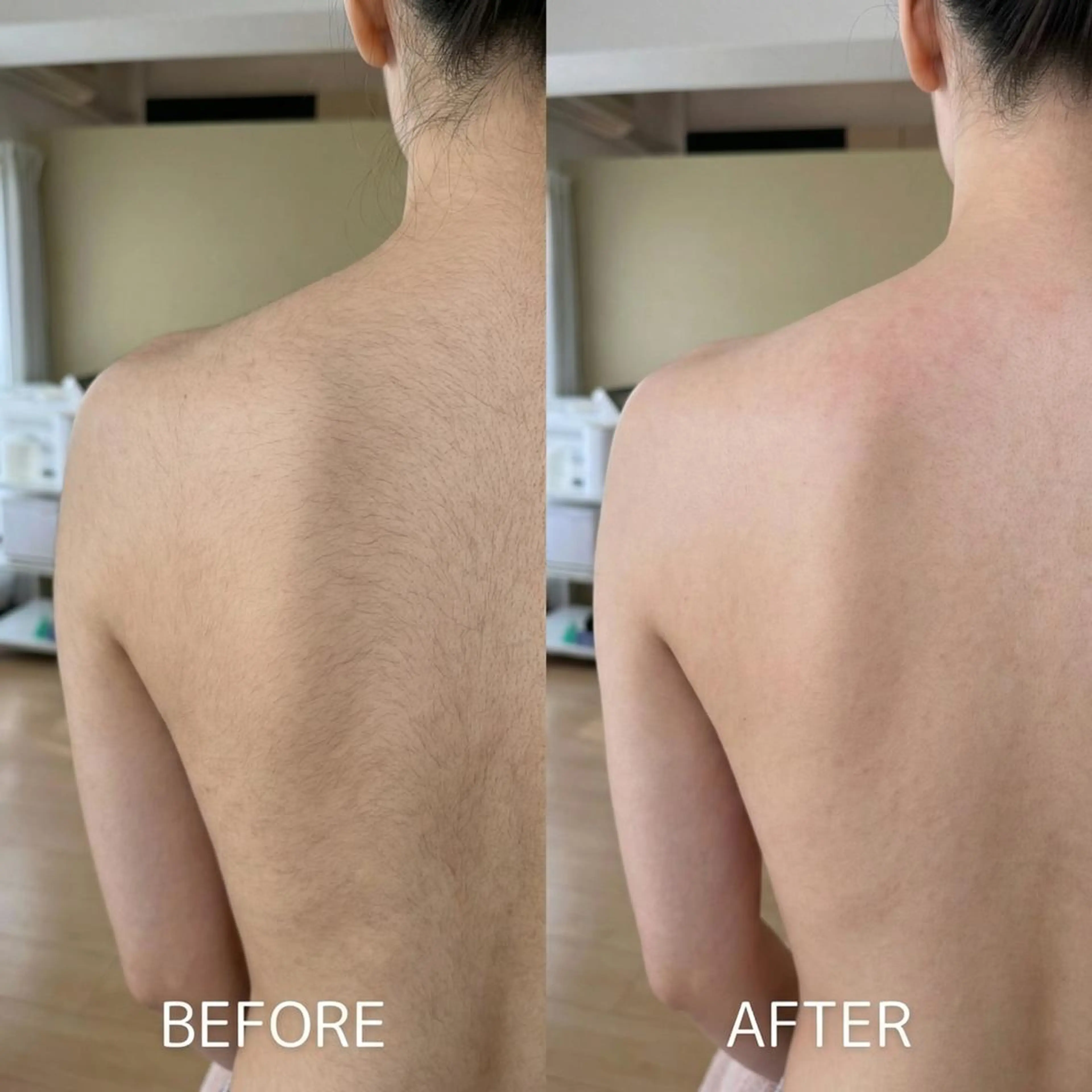 脱毛 脱毛×肌管理サロン ルネルのエステ・リラクイメージ