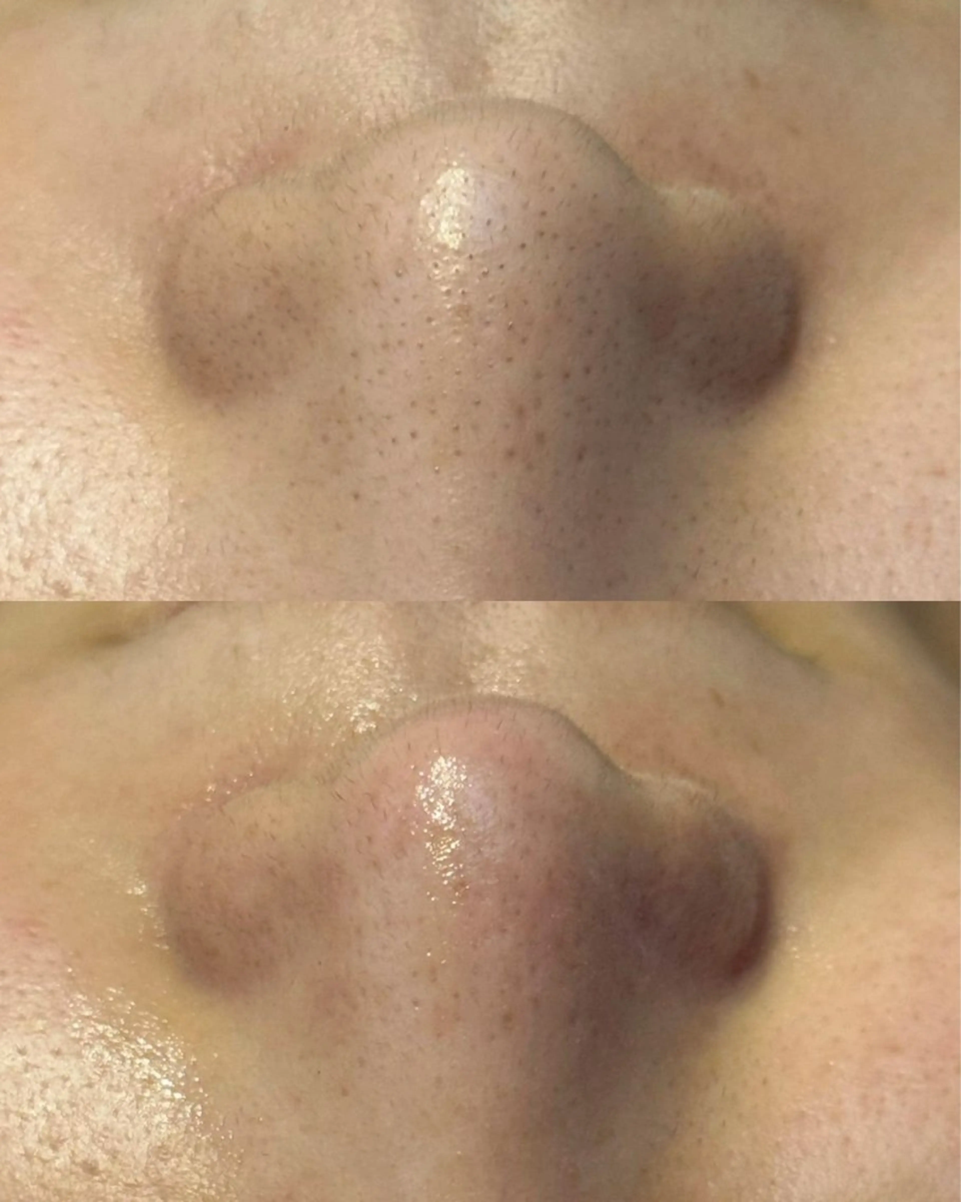 LUMIERE南堀江店所属・a ♡のその他イメージ