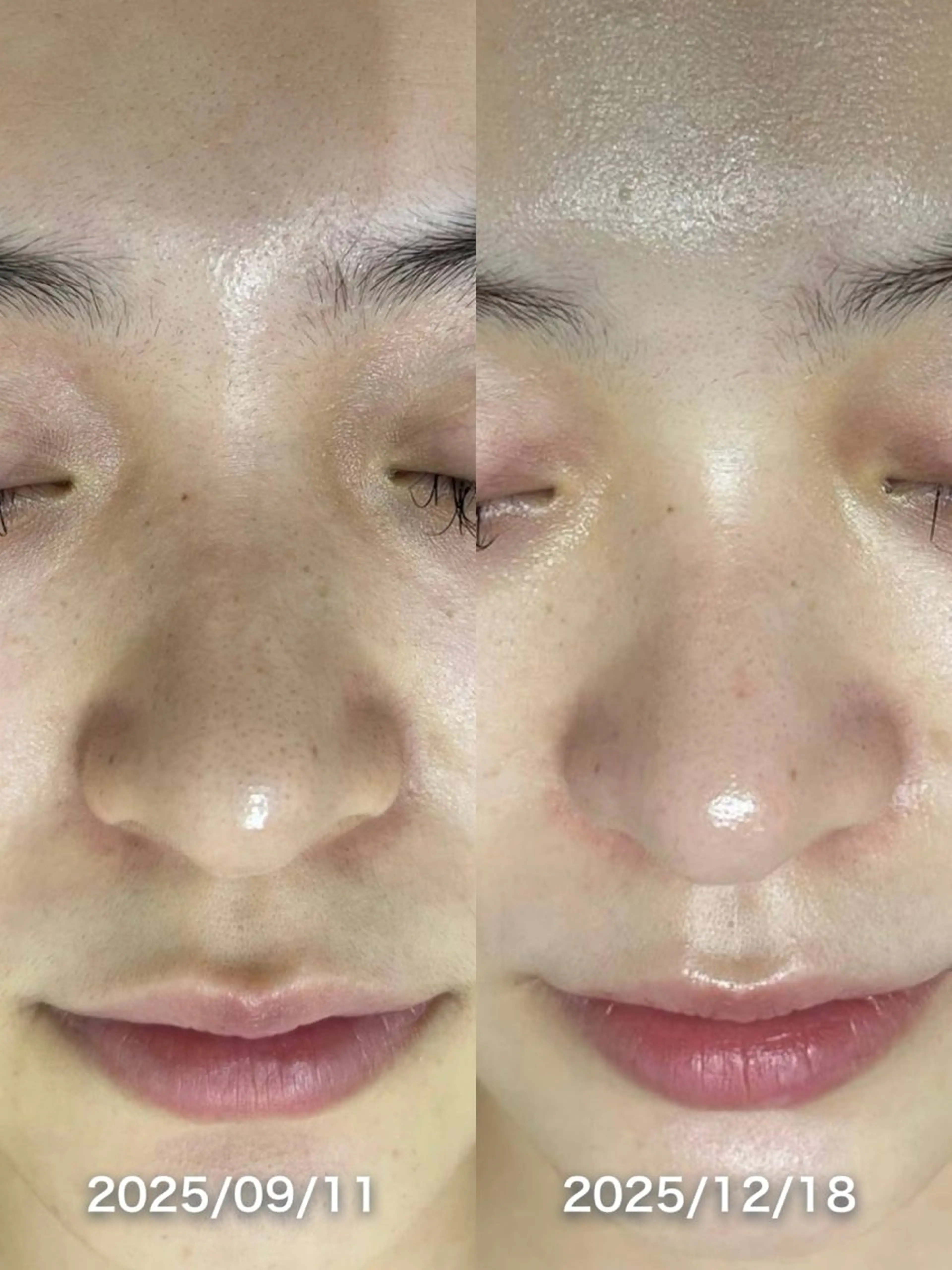 エステ 韓国美肌/肌質改善 【天神】yuiのエステ・リラクイメージ