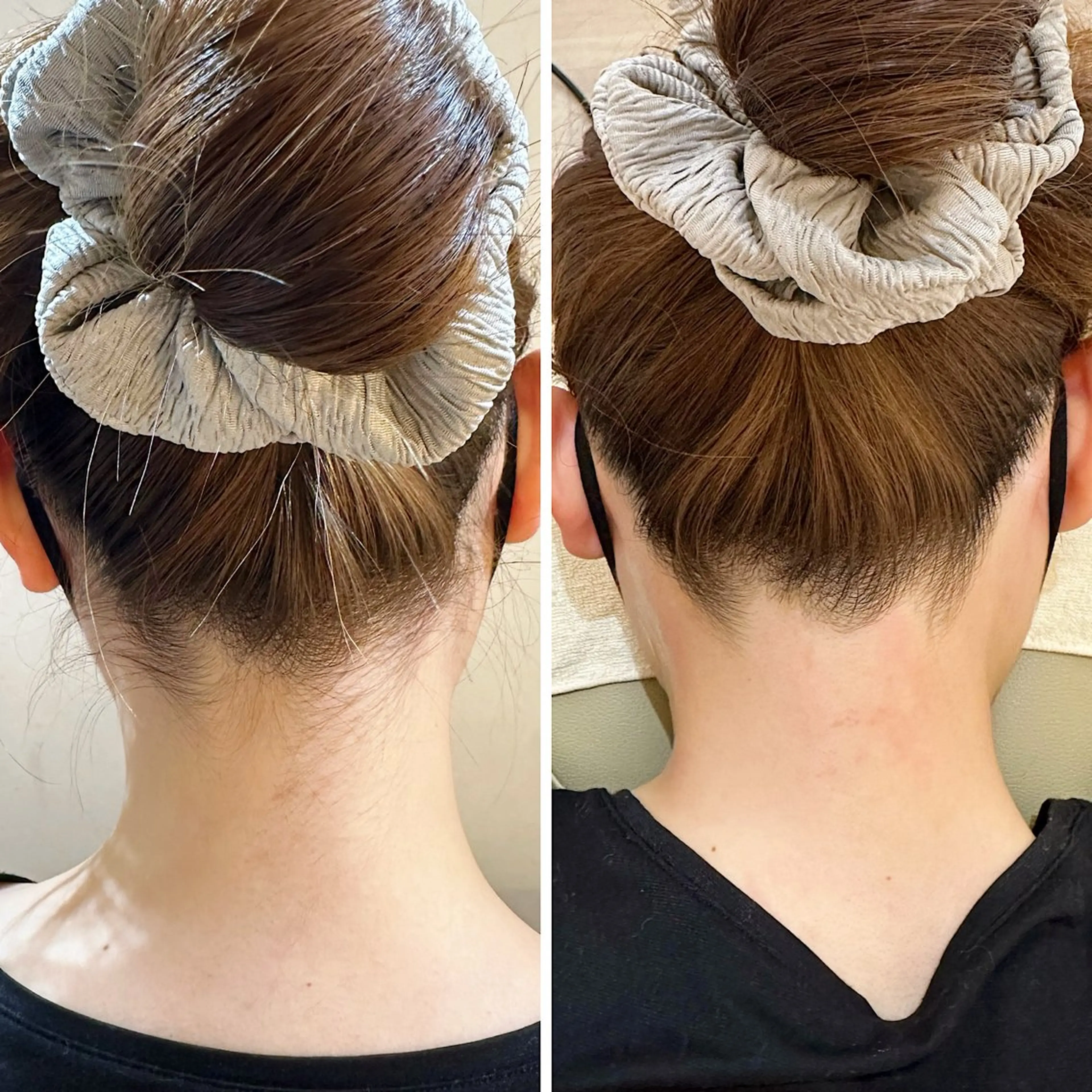 脱毛 うなじ脱毛/美肌脱毛 LABELのエステ・リラクイメージ