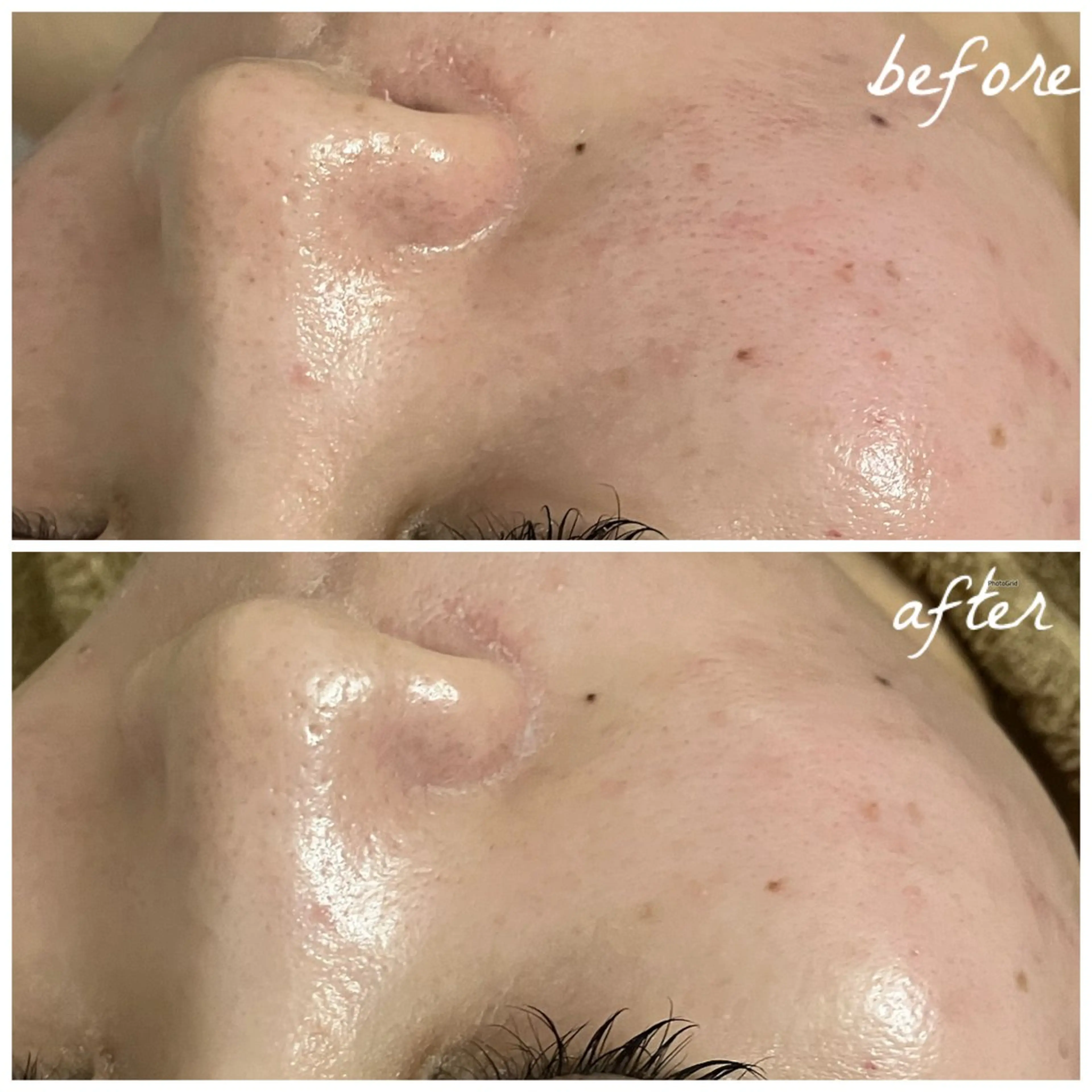 メンズ エステ メナード岐阜茜部 杉浦のエステ・リラクイメージ