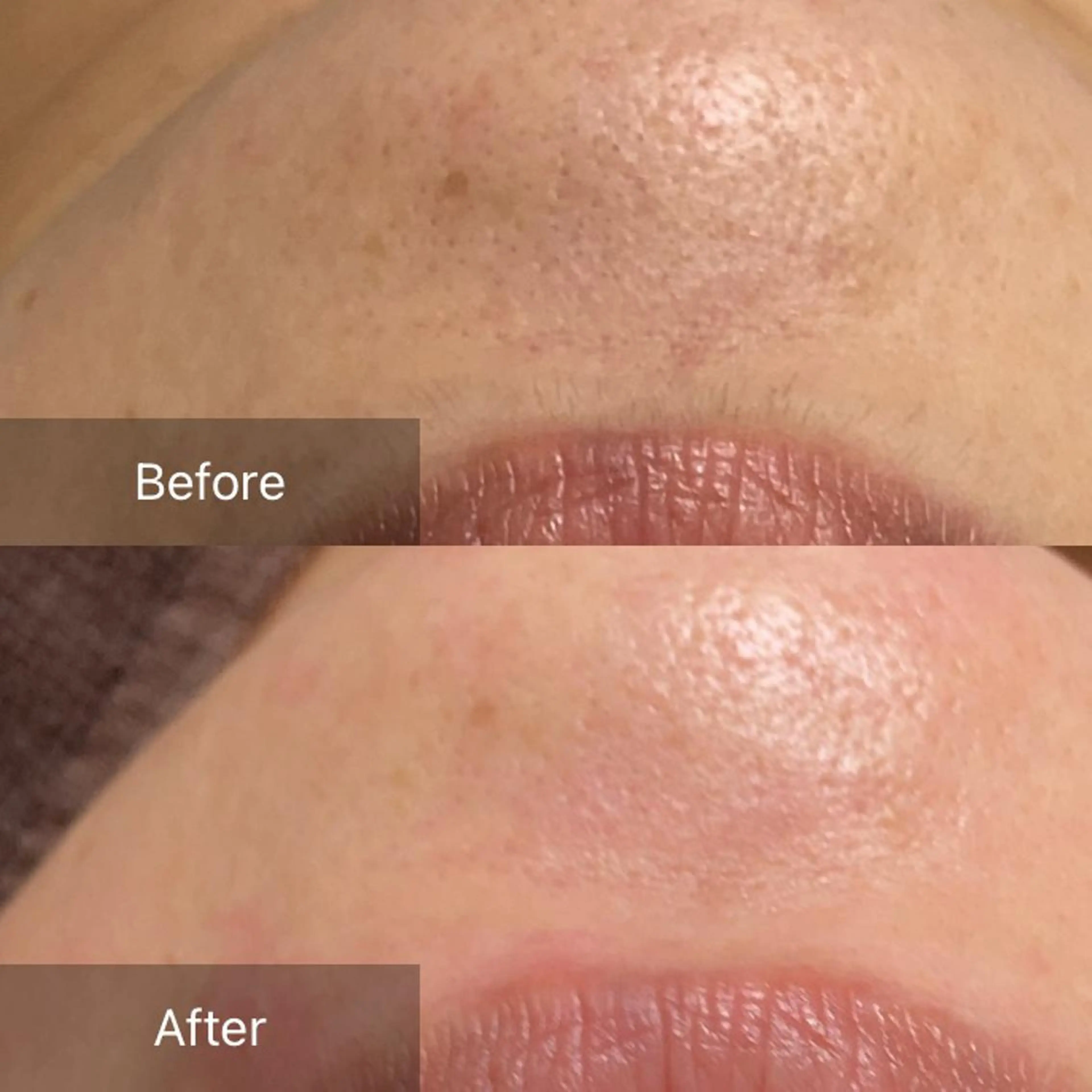 脱毛 産毛専門店 Bittoのエステ・リラクイメージ