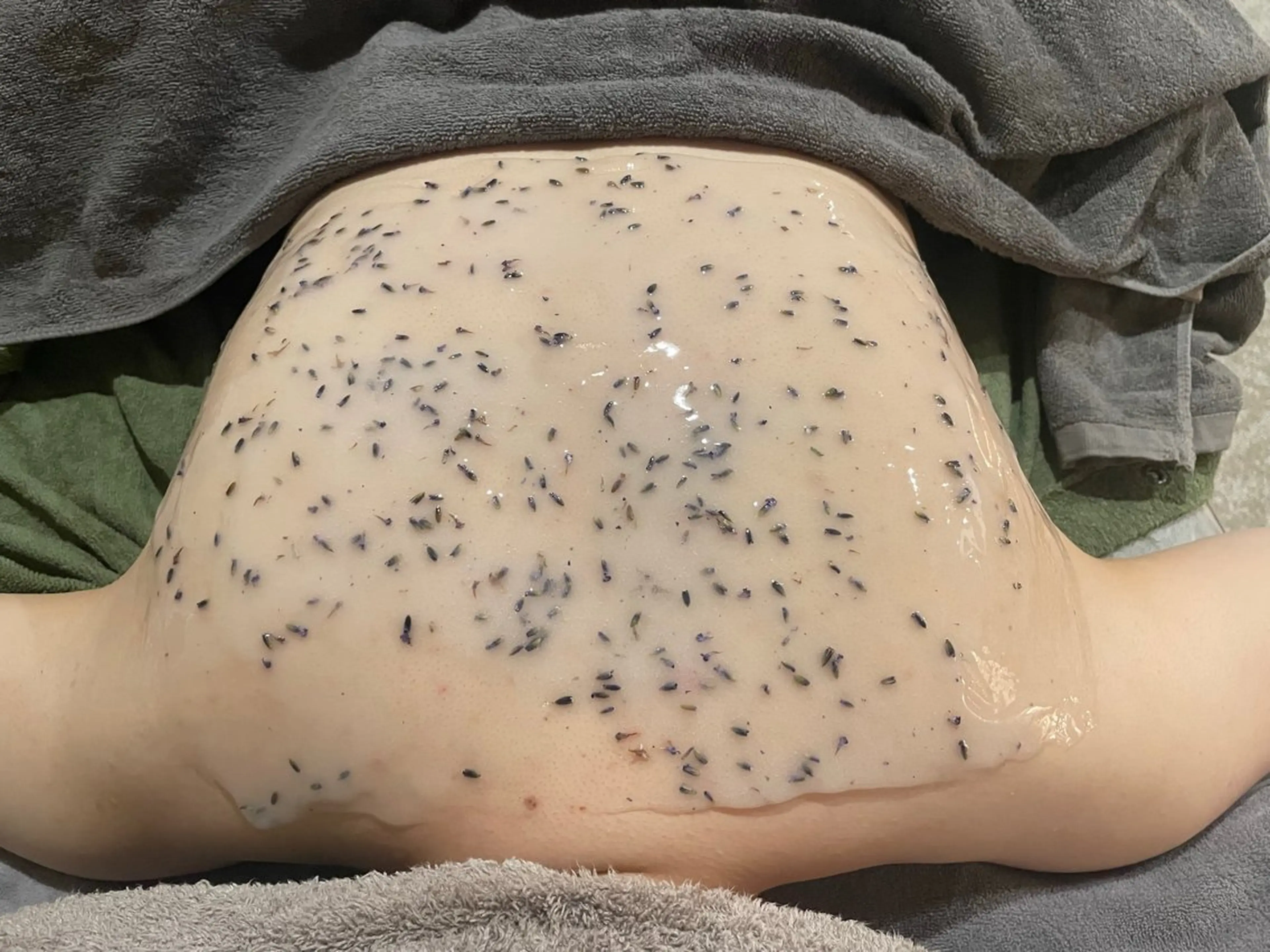 エステ Meupニキビ専門店 背中/ハーブ/肌管理のその他イメージ