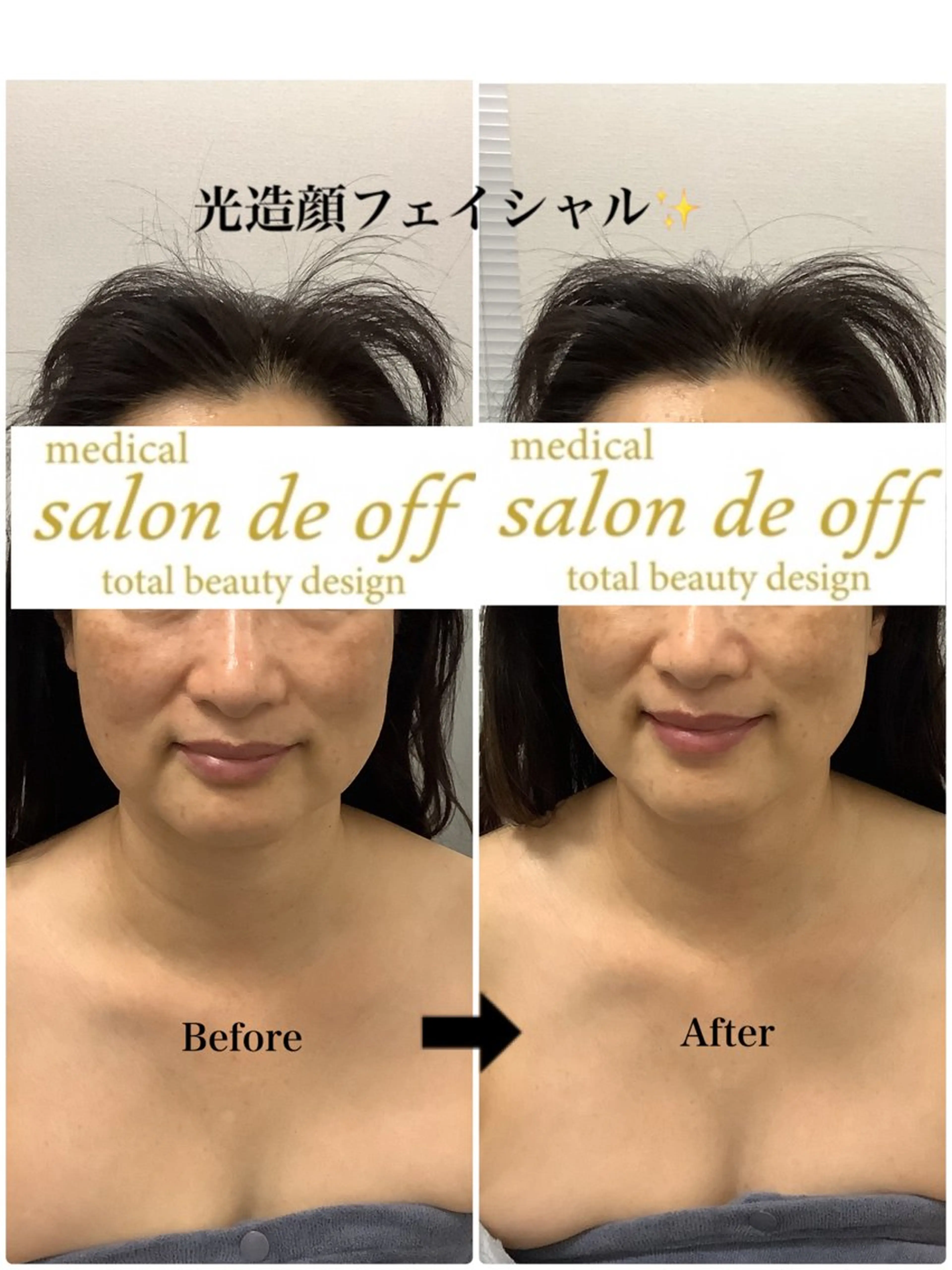 エステ リラク 🩵Tatsumi Kana🩵のエステ・リラクイメージ