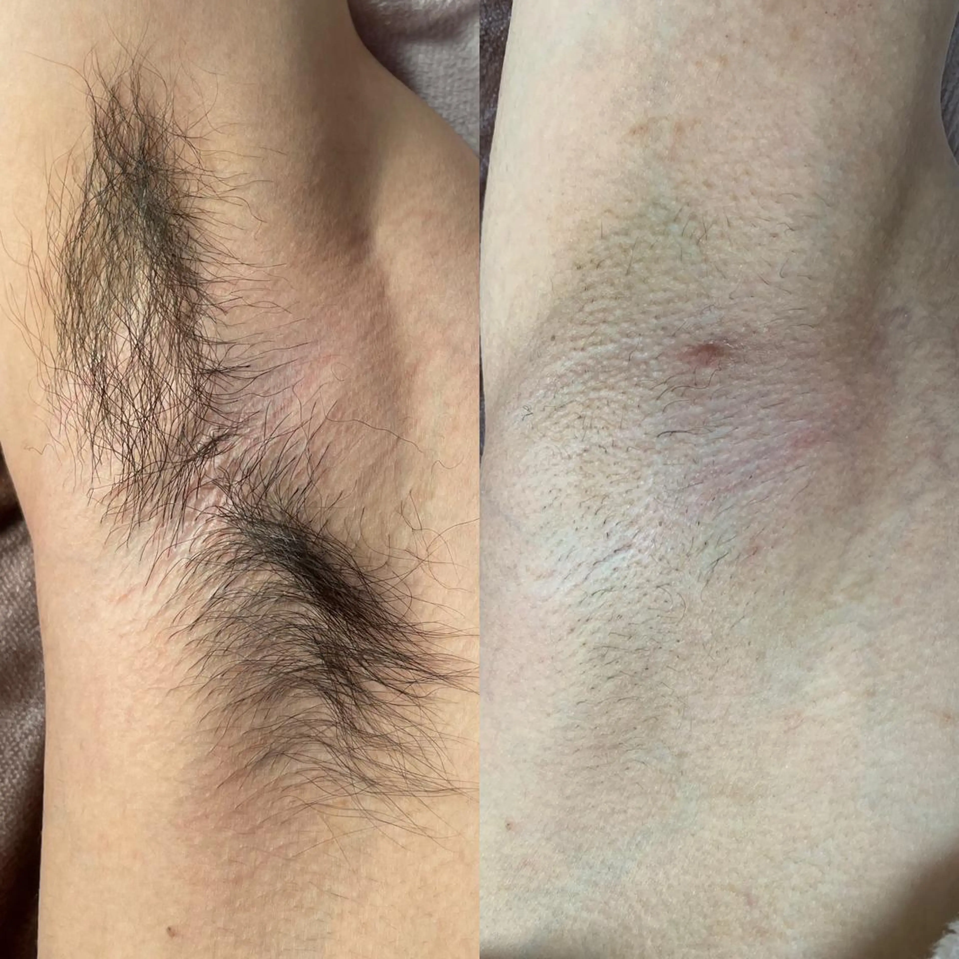 メンズ キッズ 脱毛SALON RaYNiCKのエステ・リラクイメージ