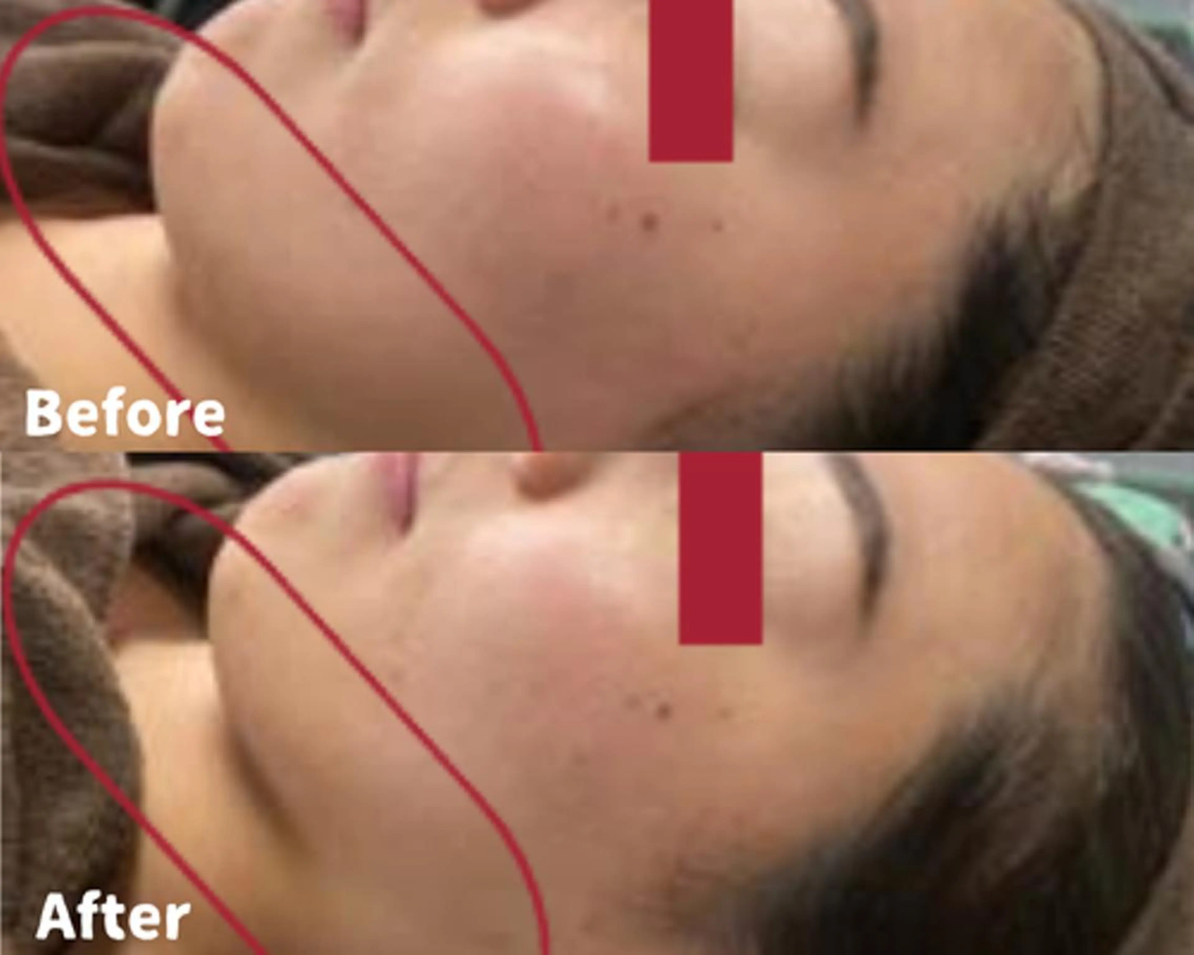 エステ リラク La chic.のエステ・リラクイメージ